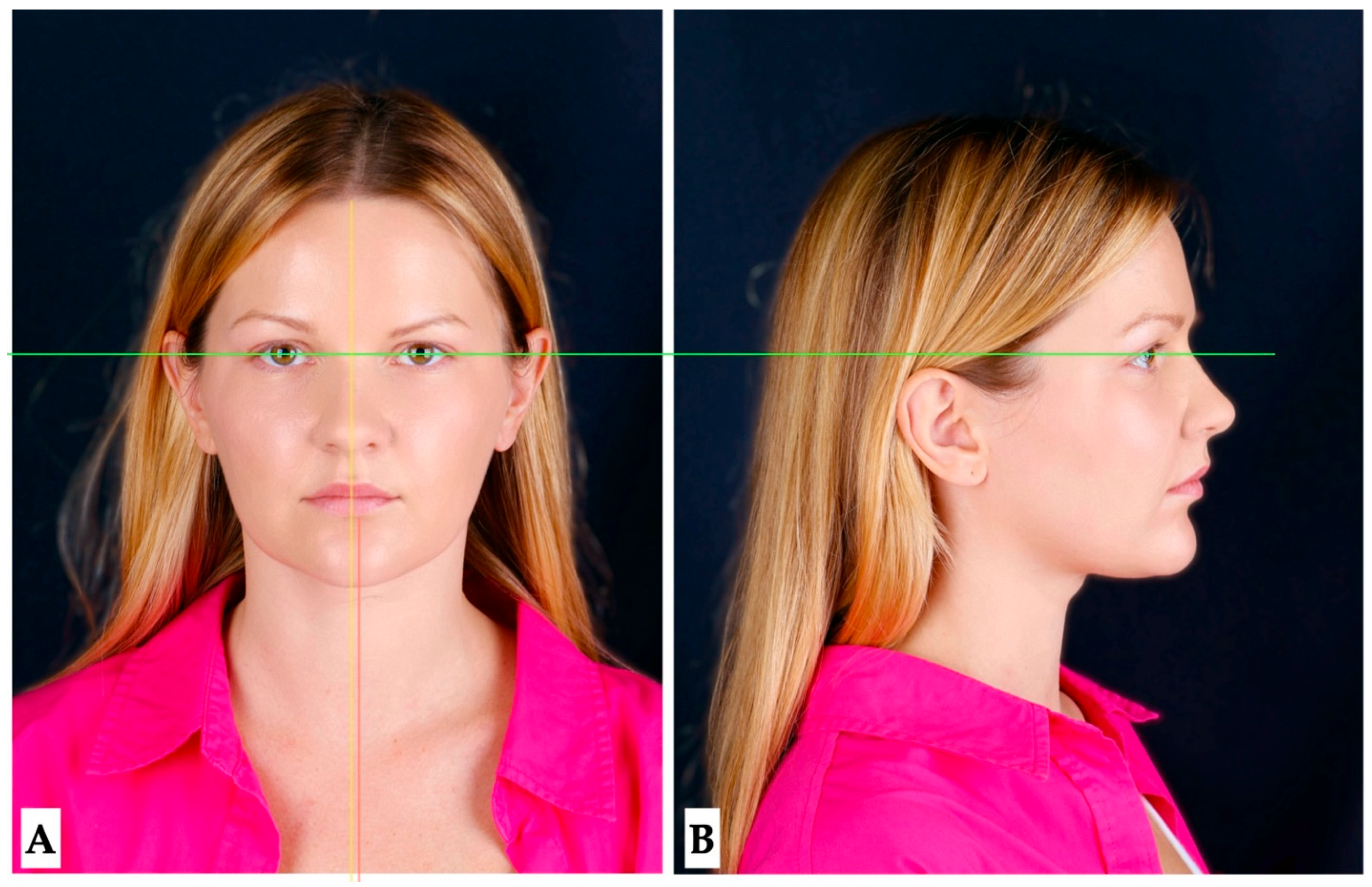 Jcm 14 07773 g002 Jcm 14 07773 g002