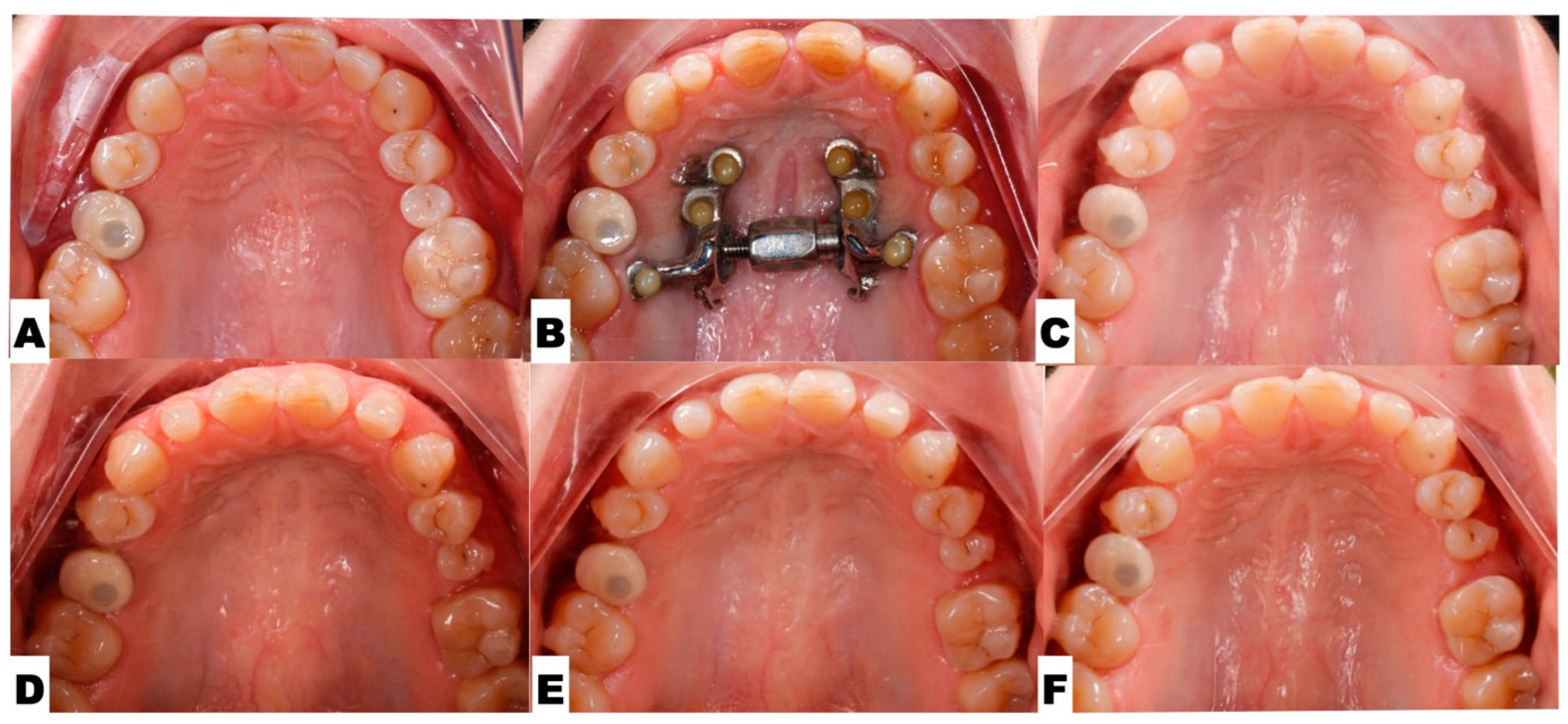 Jcm 14 07773 g016 Jcm 14 07773 g016