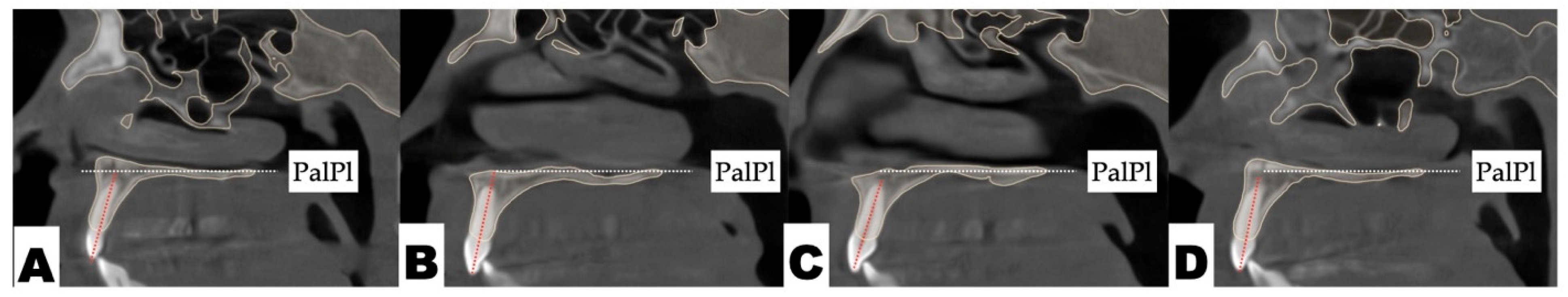 Jcm 14 07773 g017 Jcm 14 07773 g017
