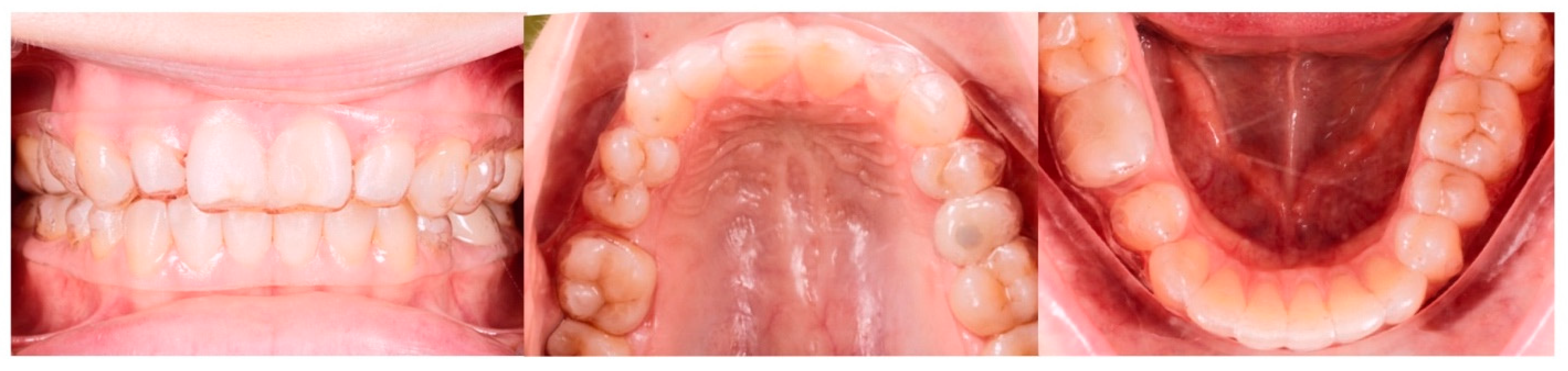 Jcm 14 07773 g018 Jcm 14 07773 g018