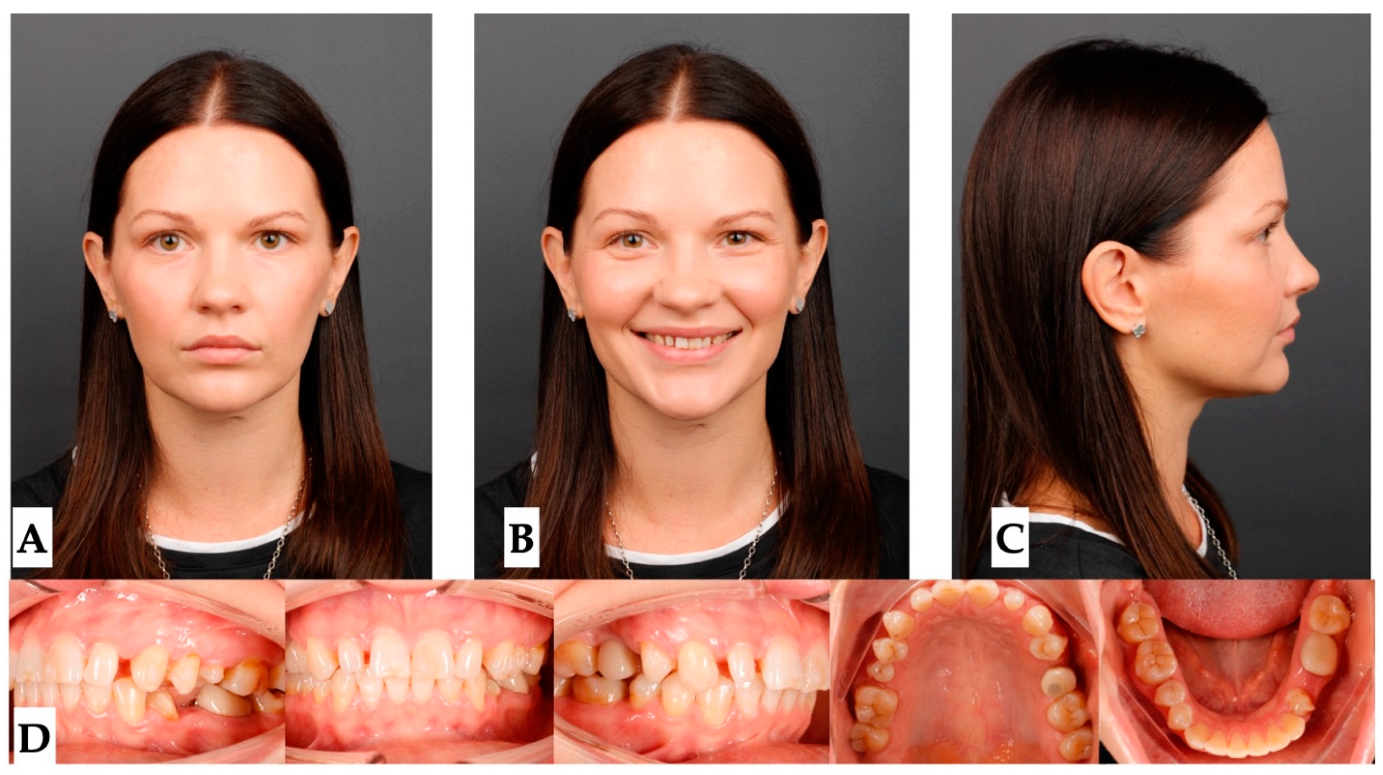 Jcm 14 07773 g019 Jcm 14 07773 g019