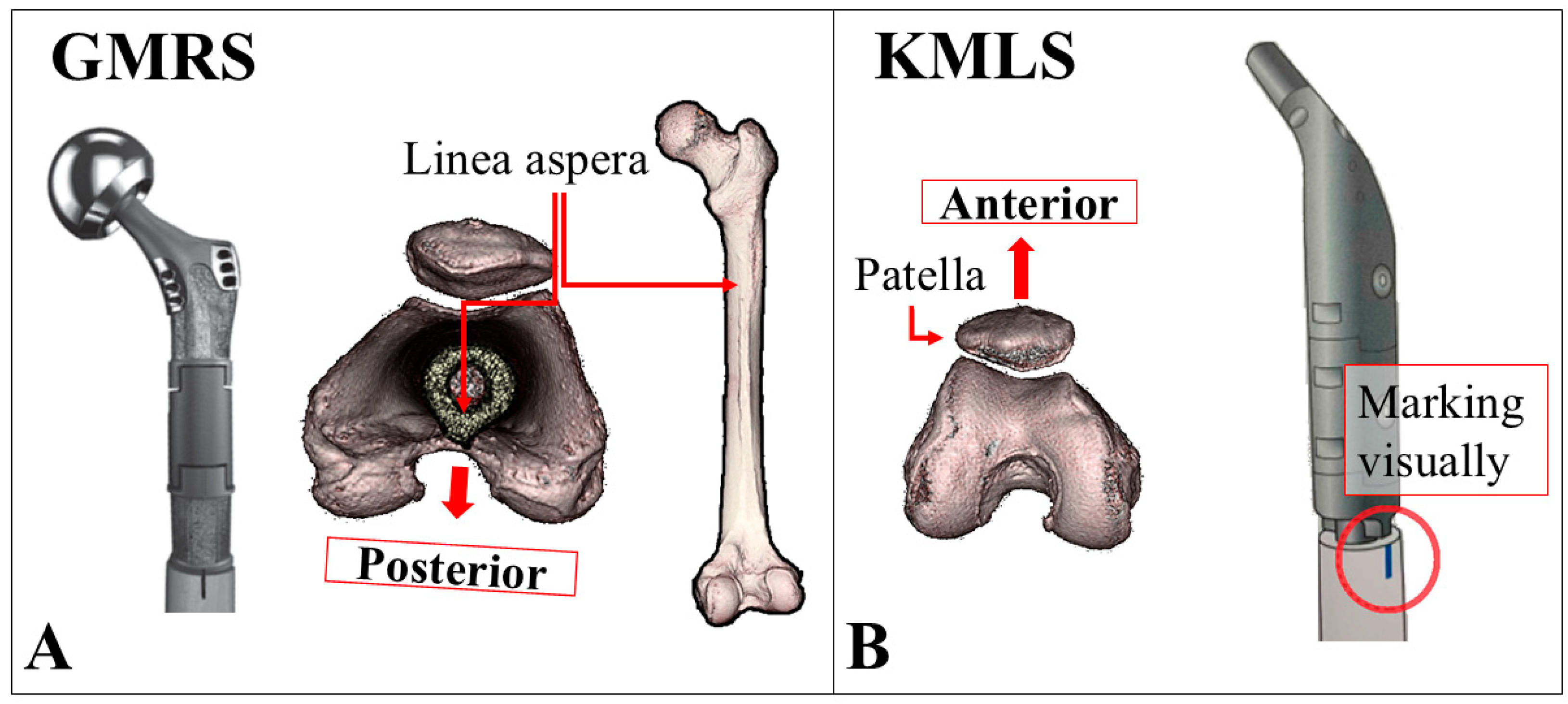 Jcm 14 07786 g002 Jcm 14 07786 g002