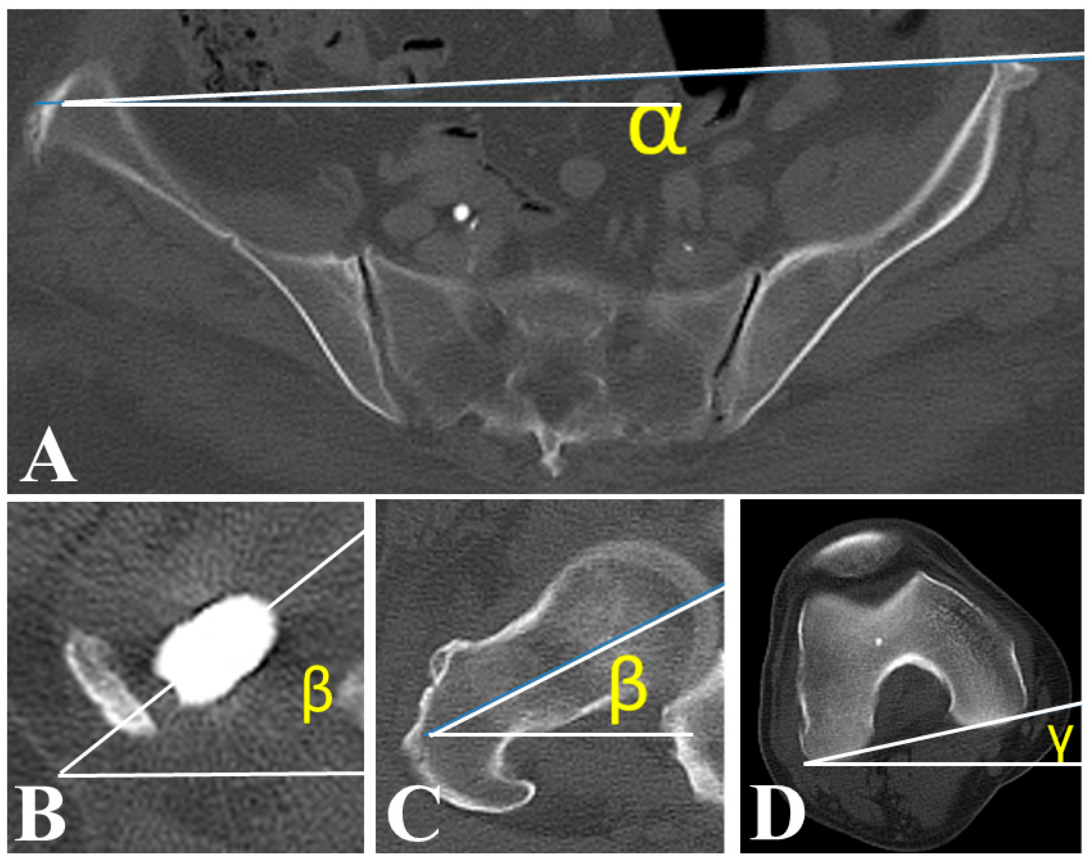 Jcm 14 07786 g003 Jcm 14 07786 g003