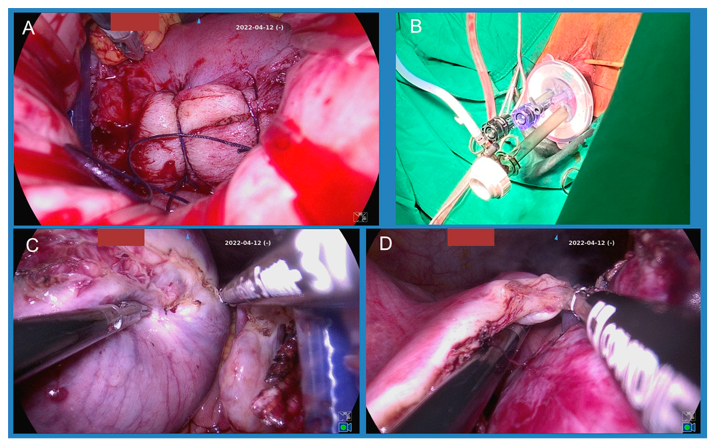 Jcm 14 07796 g001 Jcm 14 07796 g001