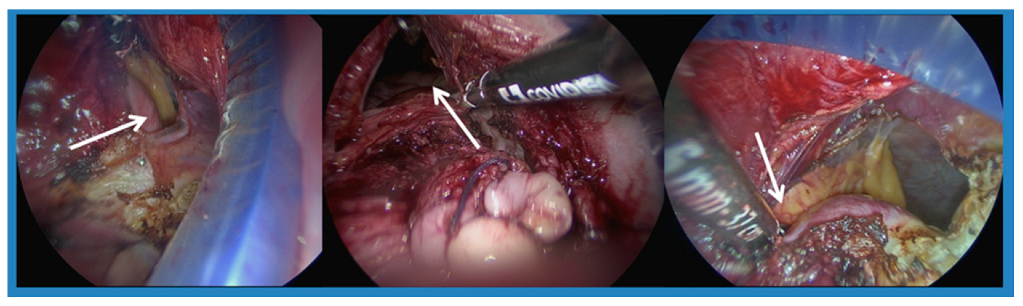 Jcm 14 07796 g002 Jcm 14 07796 g002