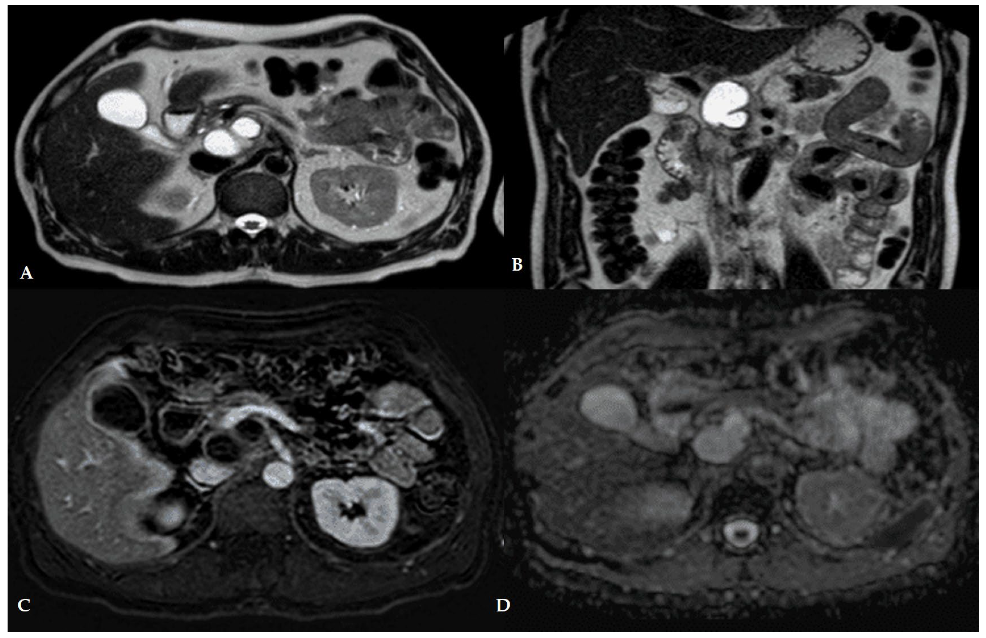 Jcm 14 07818 g002 Jcm 14 07818 g002