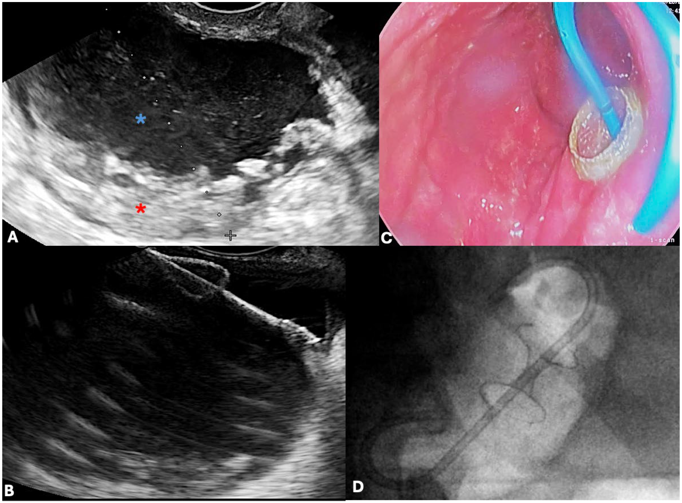 Jcm 14 07818 g003 Jcm 14 07818 g003