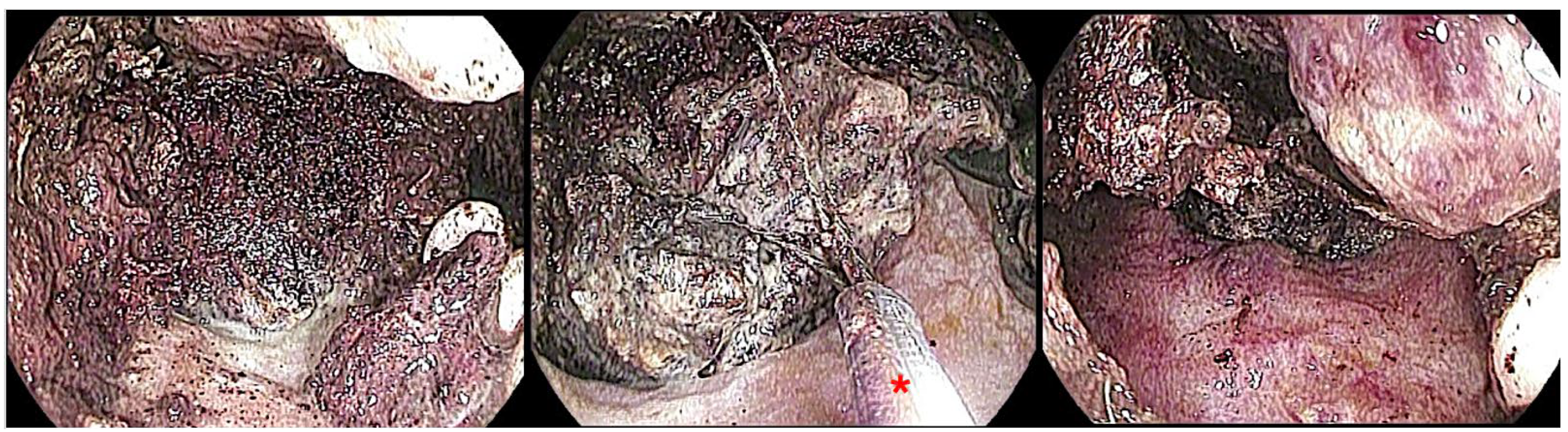 Jcm 14 07818 g004 Jcm 14 07818 g004