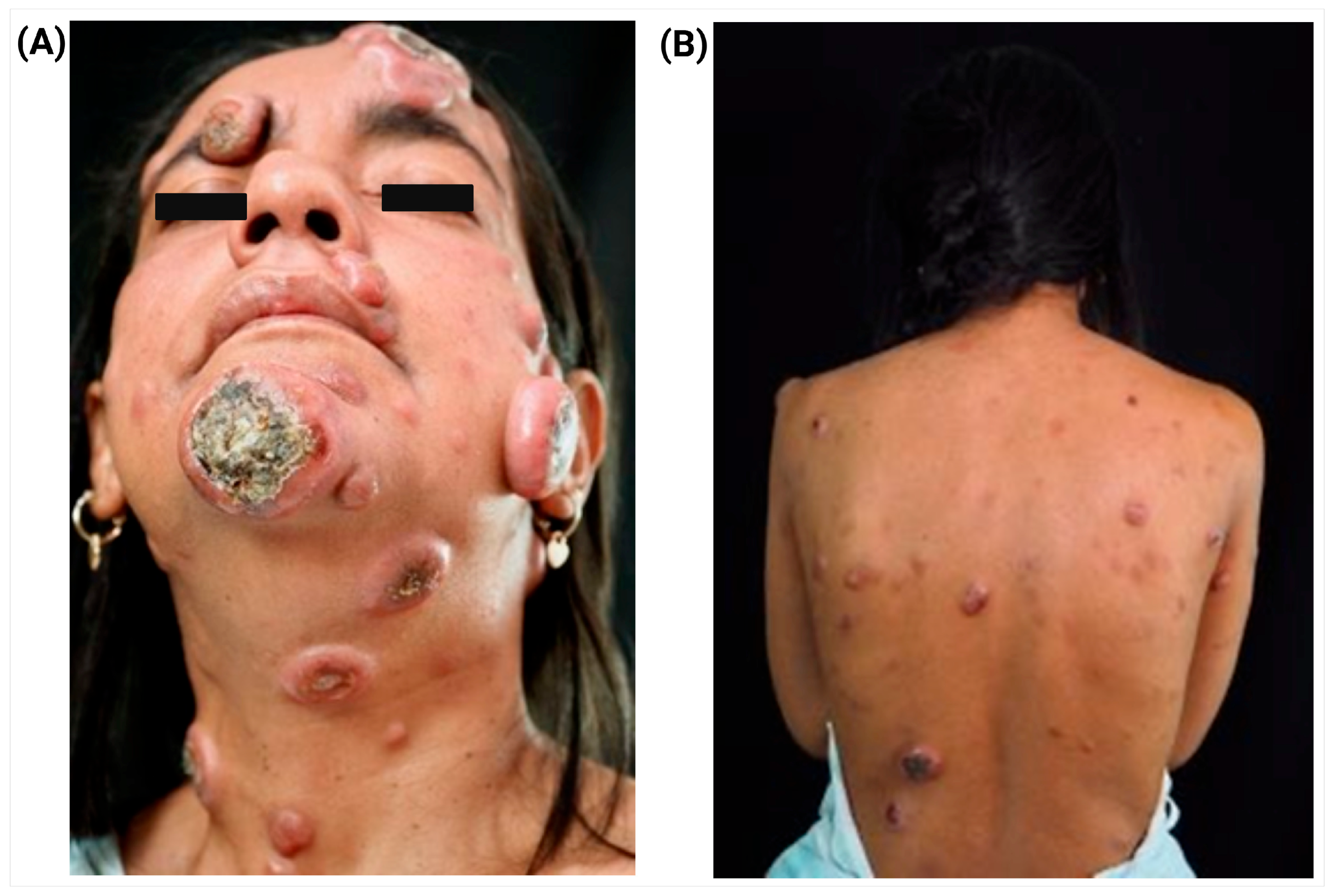 Jcm 14 07842 g001 Jcm 14 07842 g001