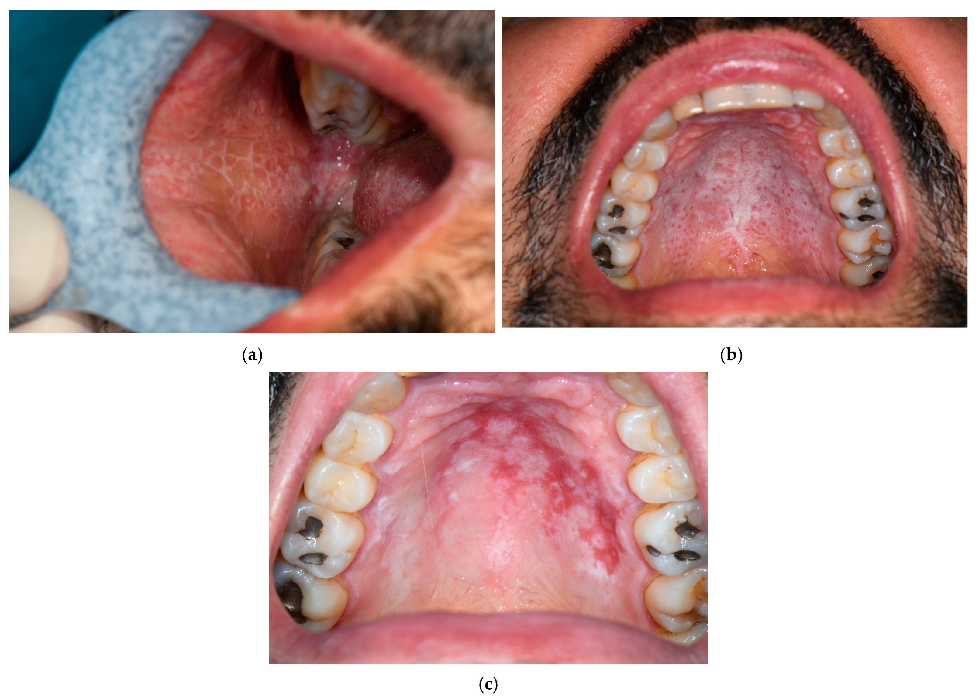 Jcm 14 07873 g002 Jcm 14 07873 g002