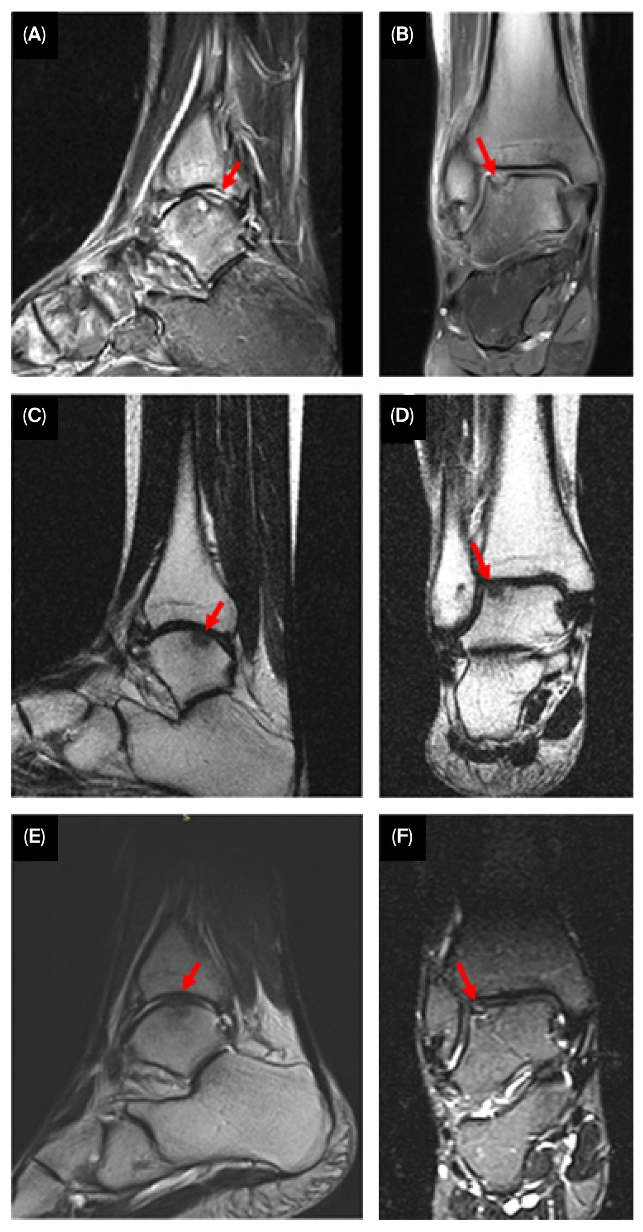 Jcm 14 07917 g004 Jcm 14 07917 g004