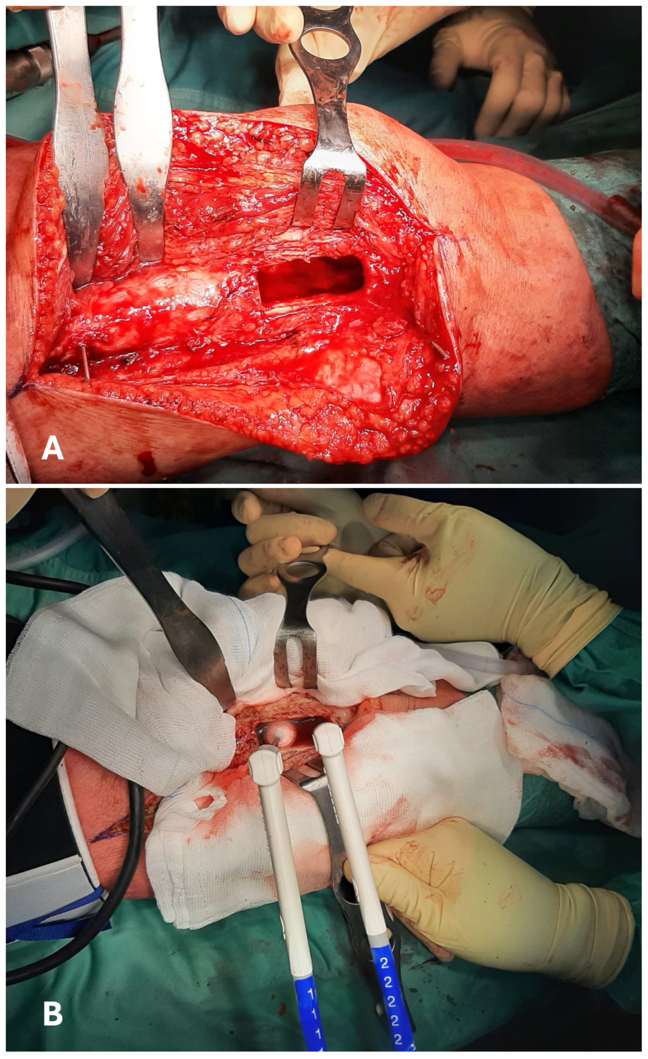 Jcm 14 08007 g004 Jcm 14 08007 g004