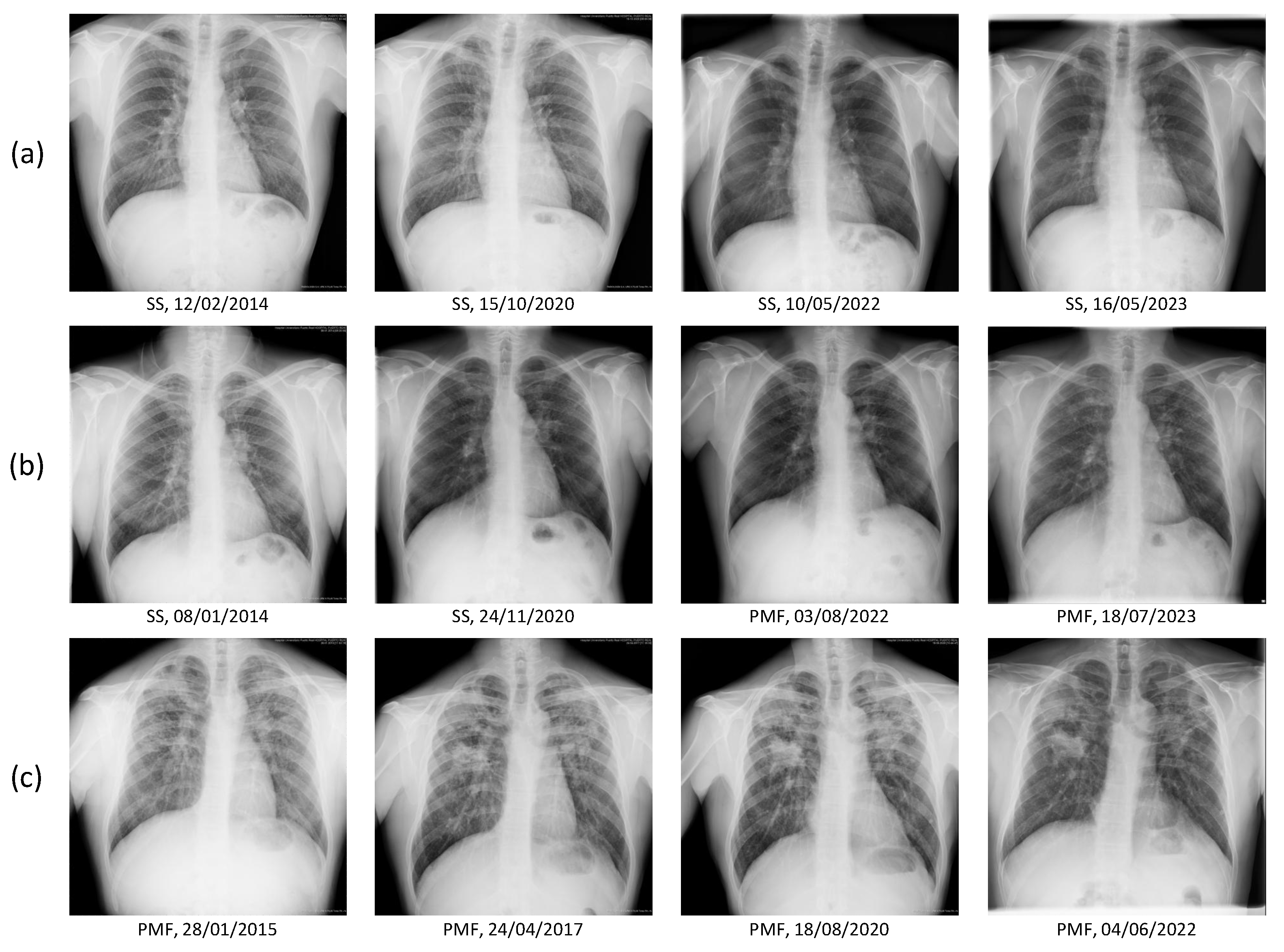Jcm 14 08074 g008 Jcm 14 08074 g008