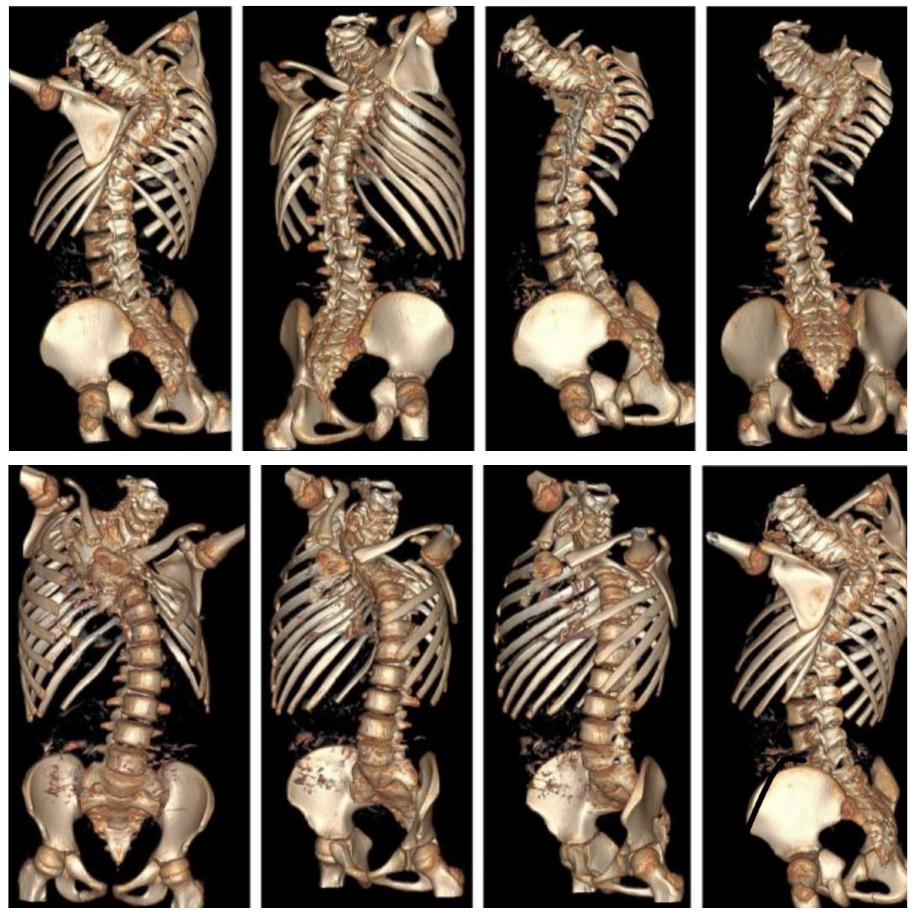 Jcm 14 08085 g002 Jcm 14 08085 g002