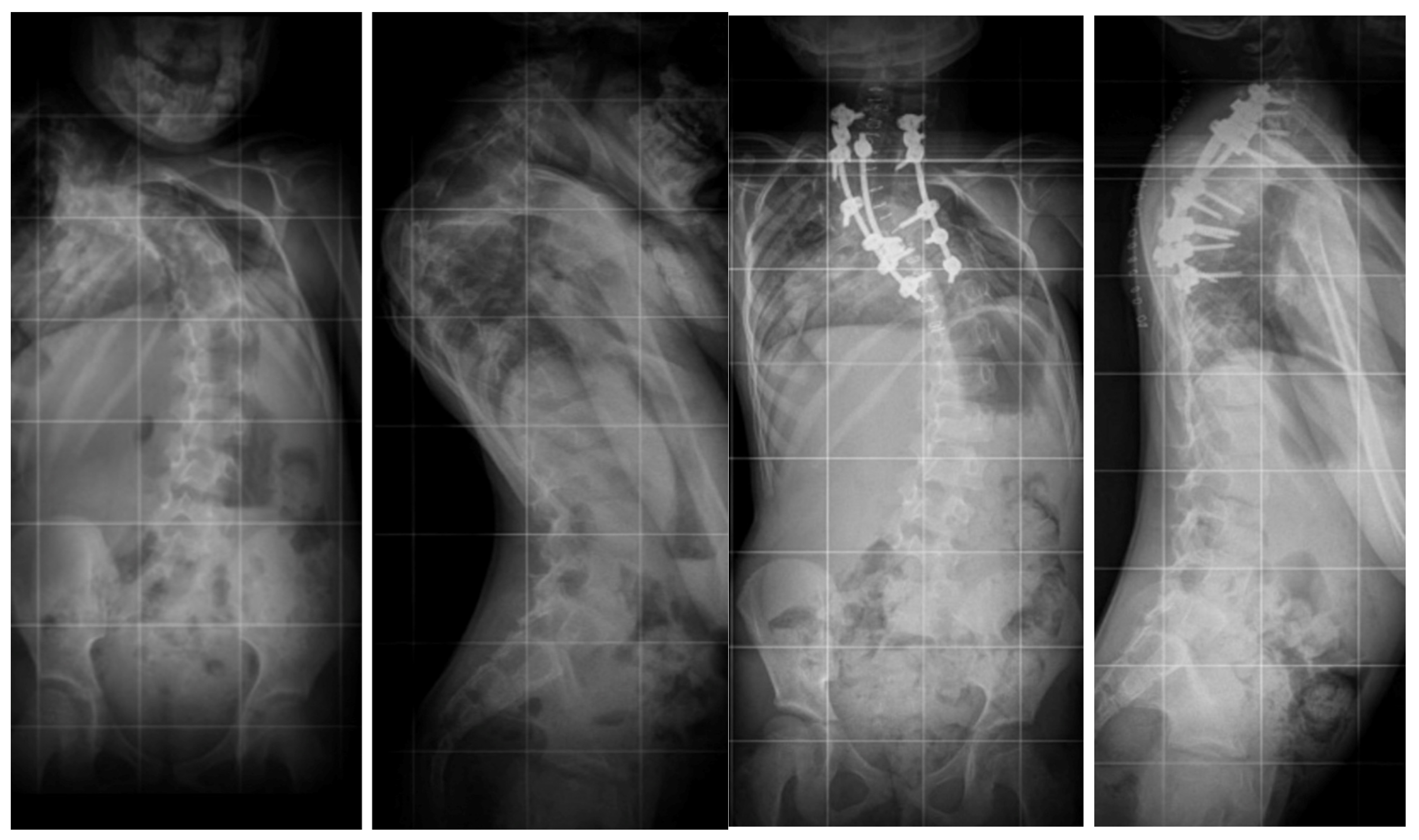 Jcm 14 08085 g003 Jcm 14 08085 g003