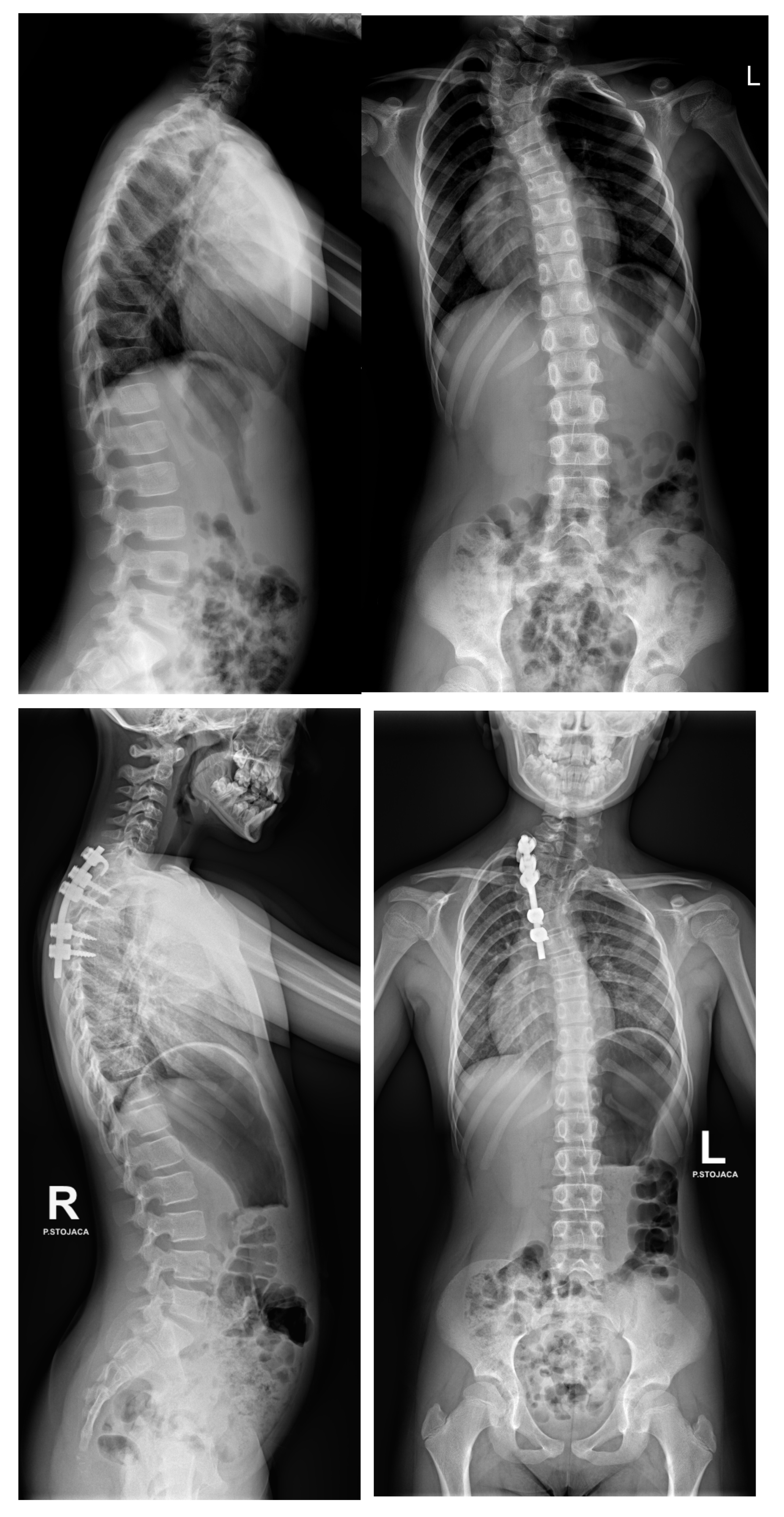 Jcm 14 08085 g004 Jcm 14 08085 g004