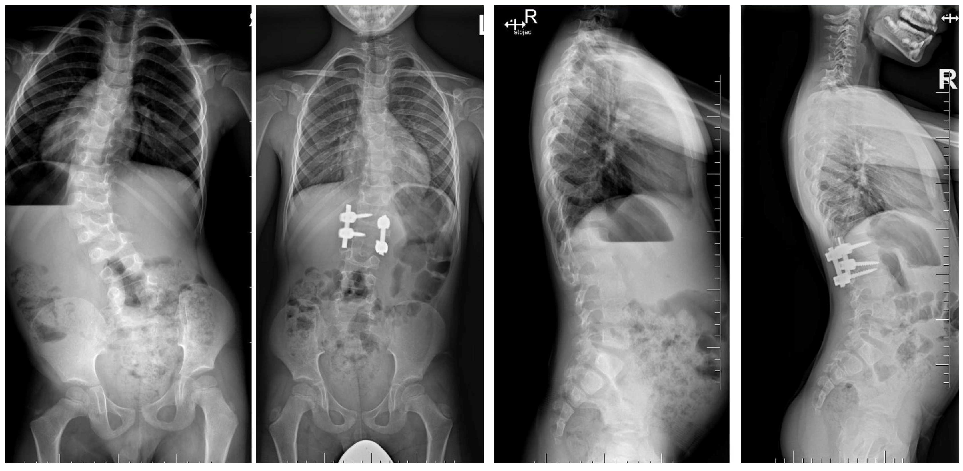 Jcm 14 08085 g005 Jcm 14 08085 g005