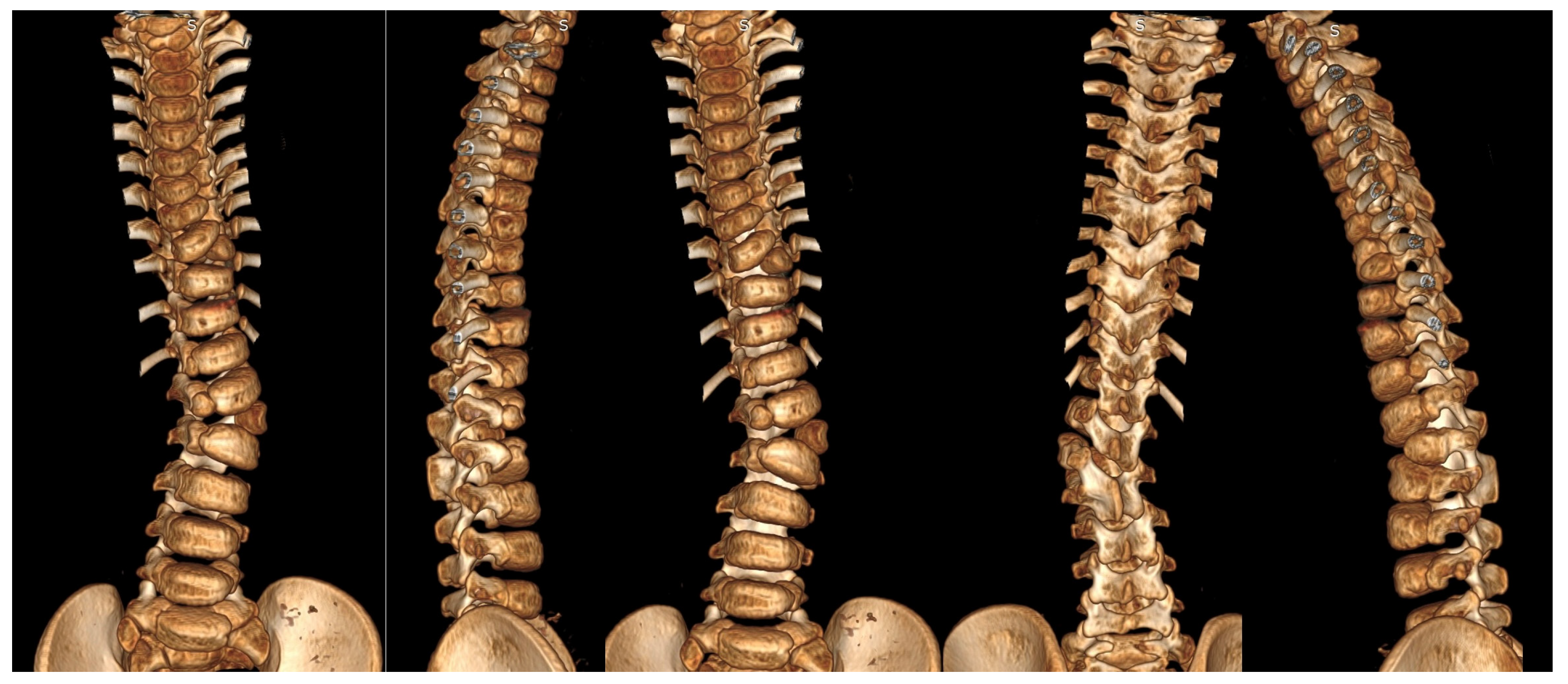 Jcm 14 08085 g006 Jcm 14 08085 g006