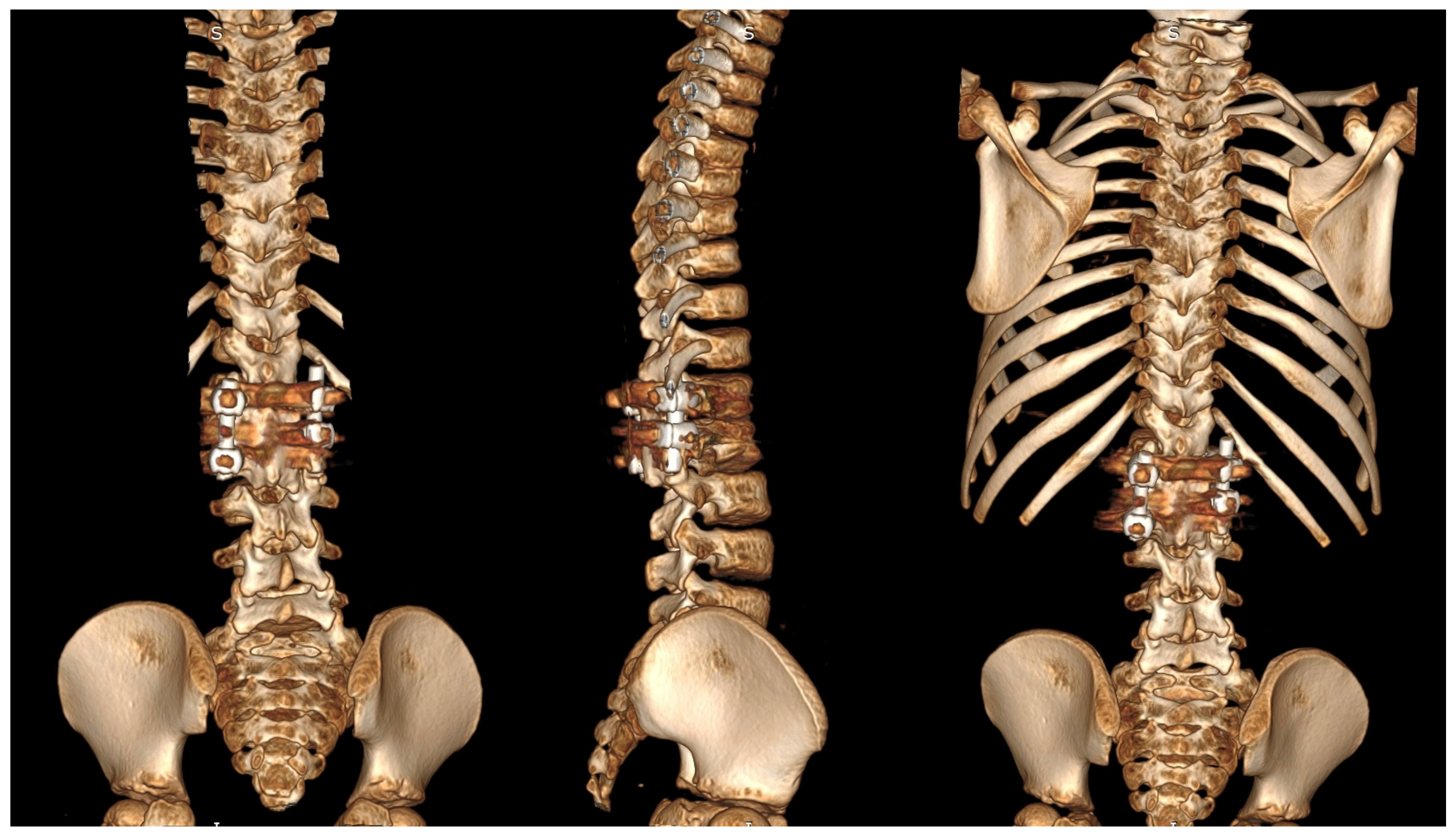 Jcm 14 08085 g007 Jcm 14 08085 g007