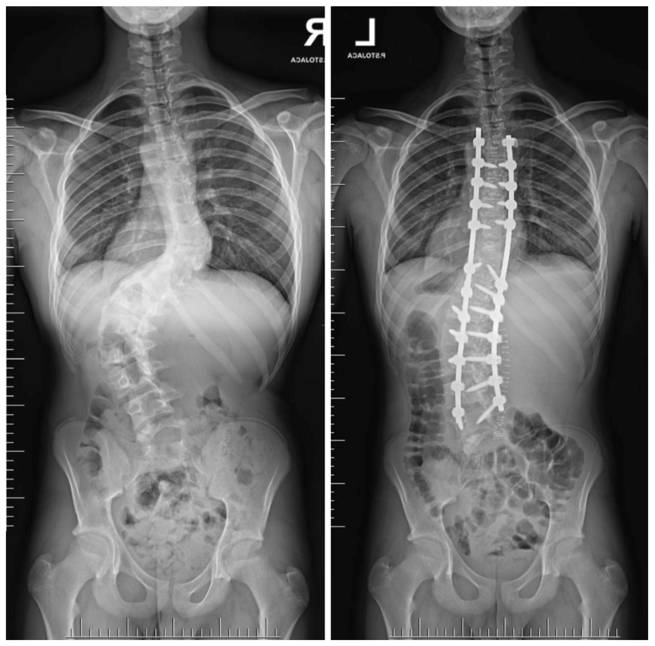 Jcm 14 08085 g011a Jcm 14 08085 g011a