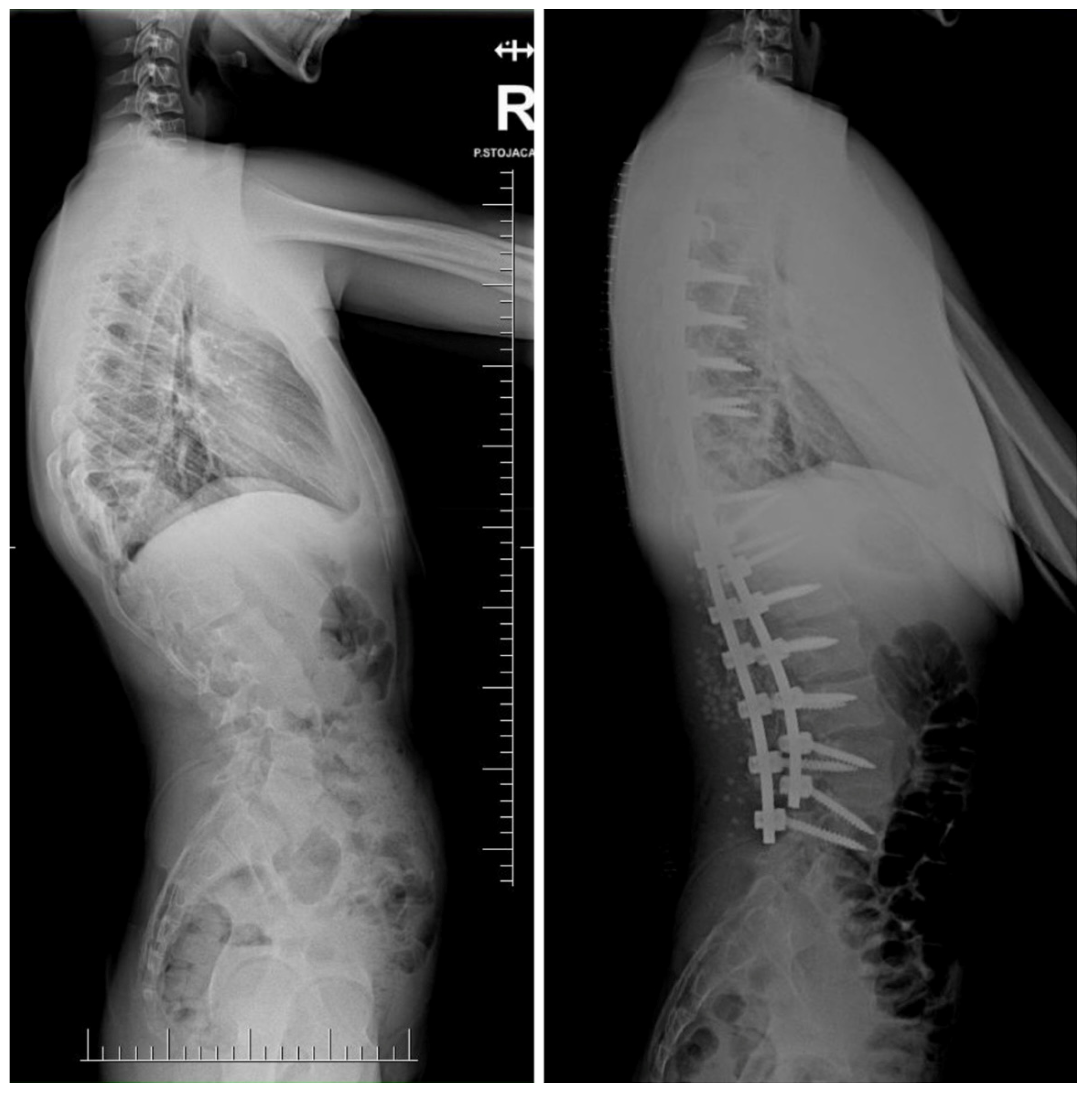 Jcm 14 08085 g011b Jcm 14 08085 g011b