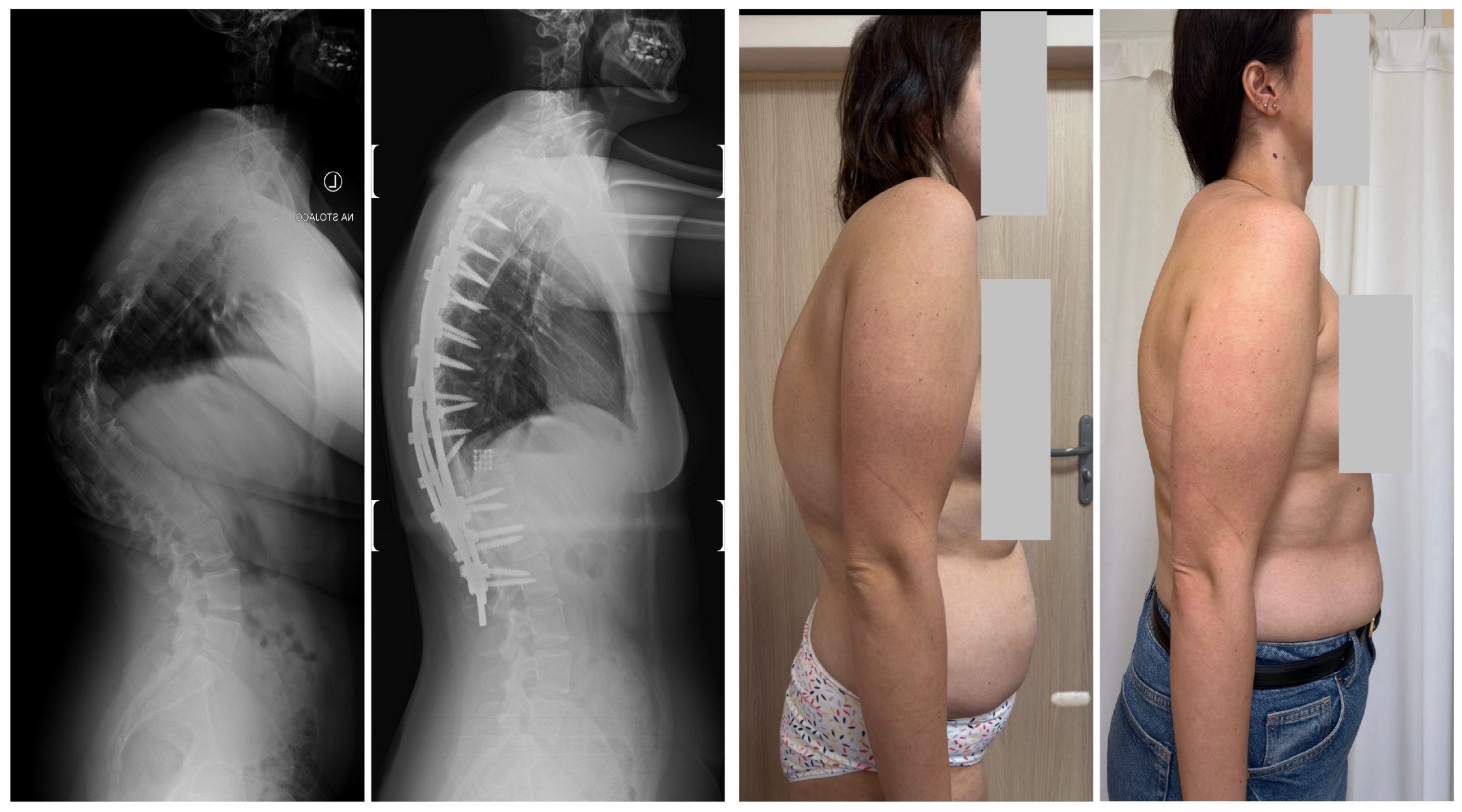 Jcm 14 08085 g014a Jcm 14 08085 g014a