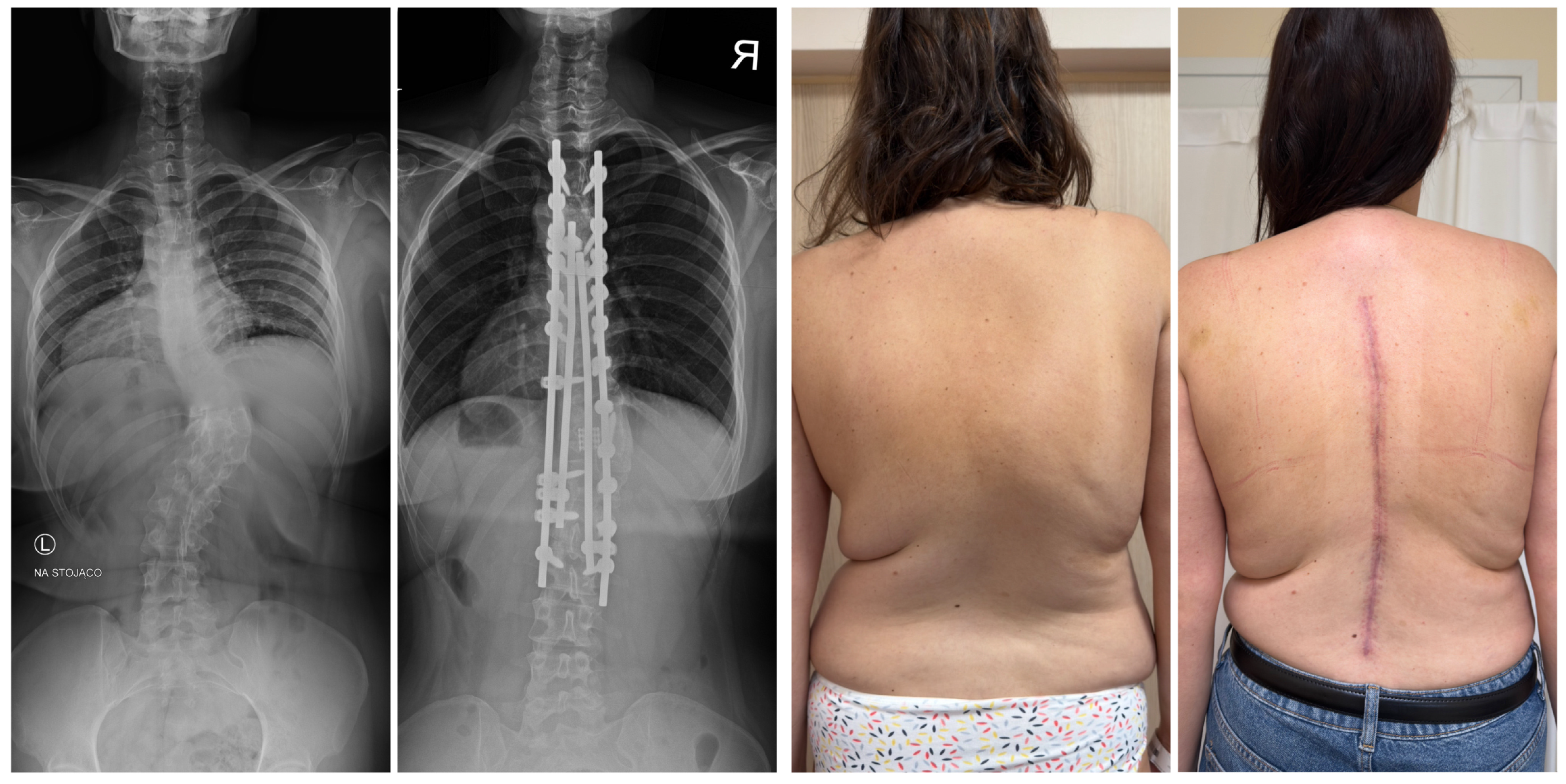 Jcm 14 08085 g014b Jcm 14 08085 g014b