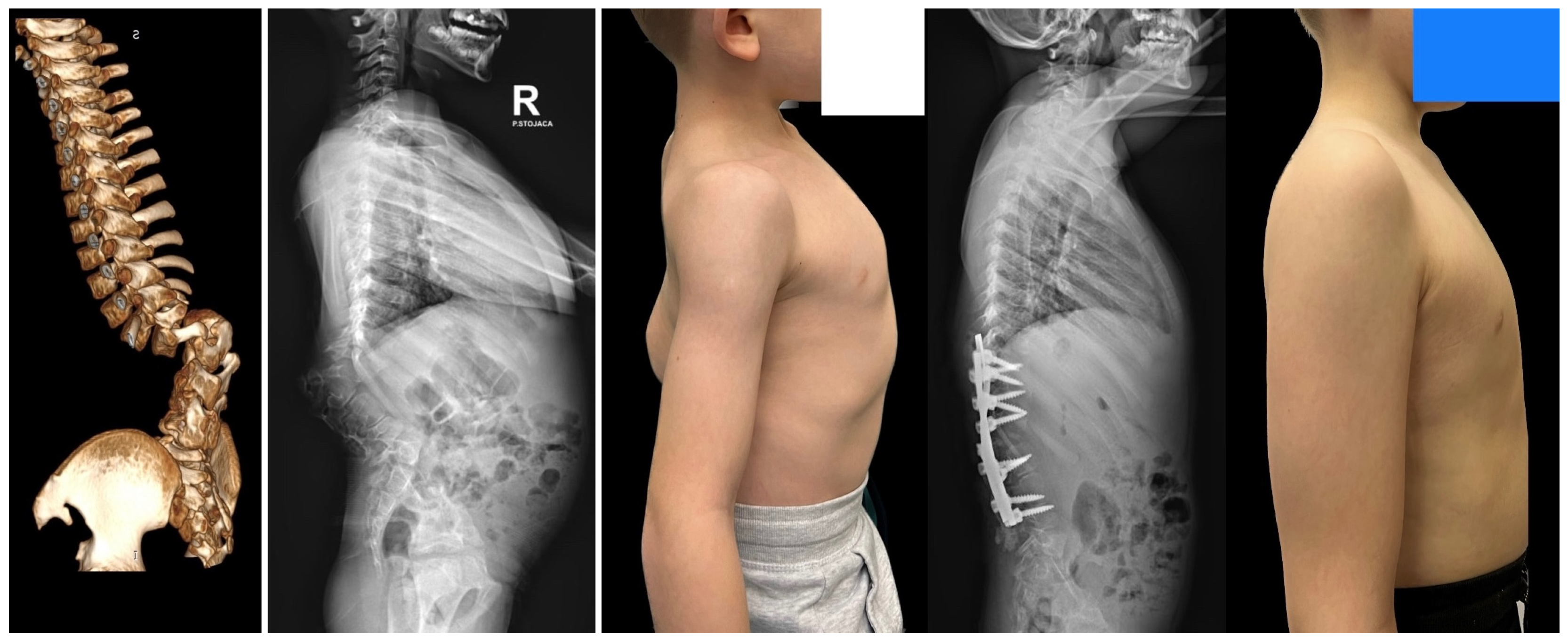 Jcm 14 08085 g015b Jcm 14 08085 g015b