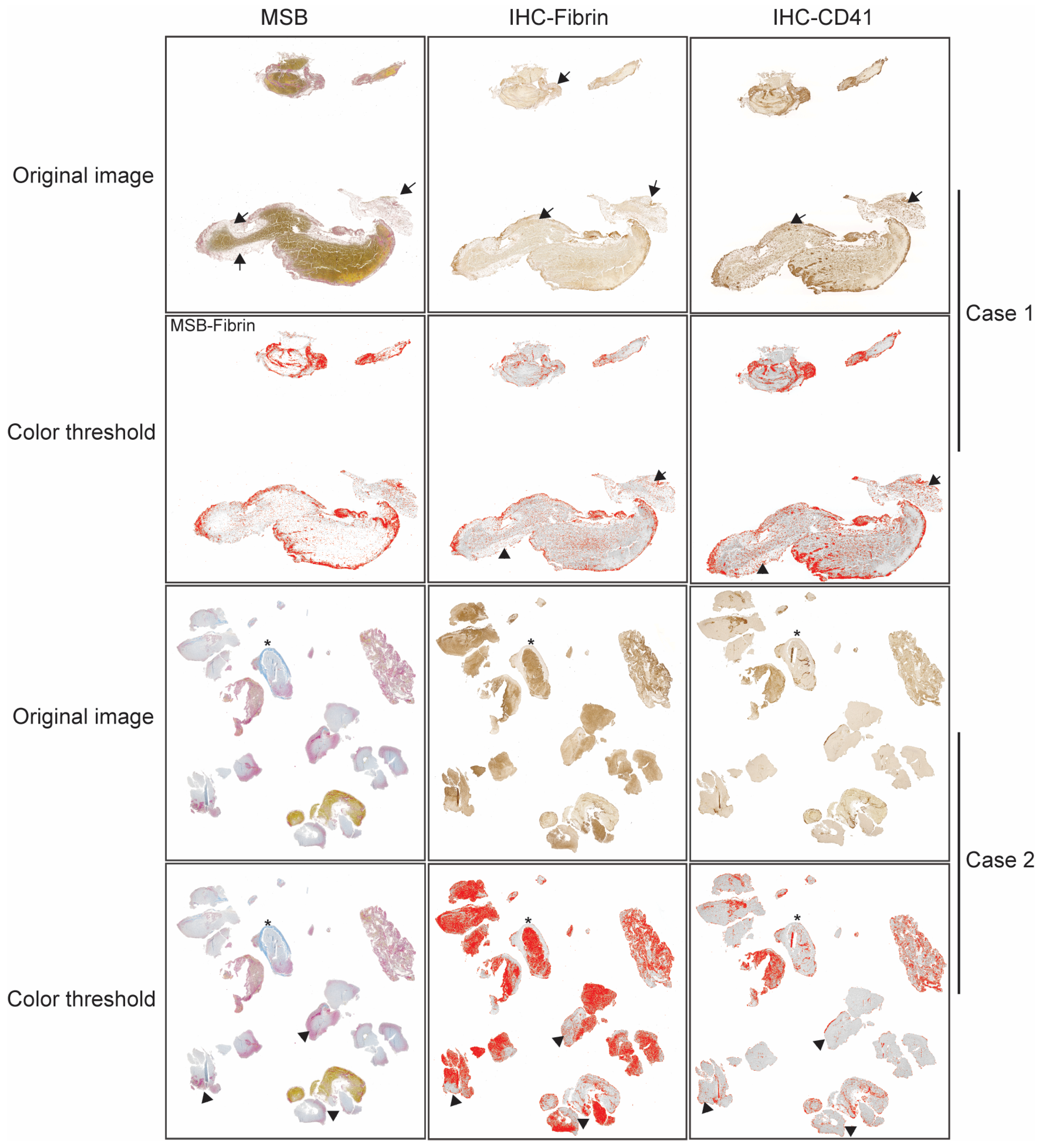 Jcm 14 08088 g002 Jcm 14 08088 g002