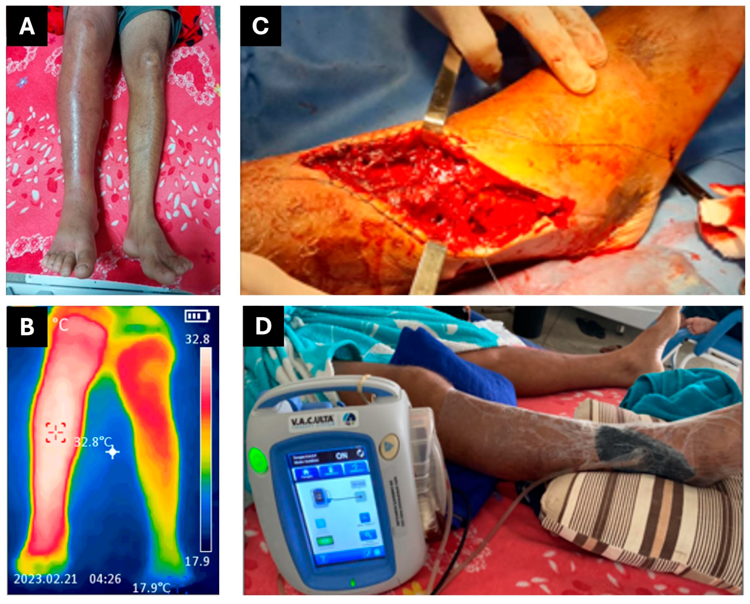 Jcm 14 08129 g001 Jcm 14 08129 g001
