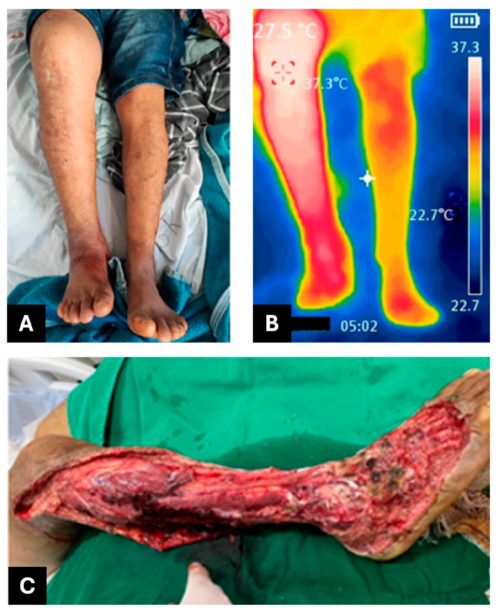 Jcm 14 08129 g002 Jcm 14 08129 g002