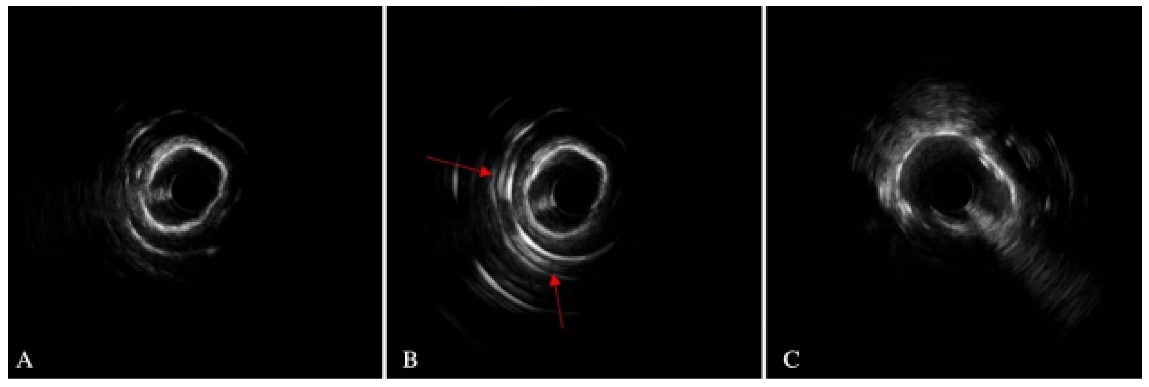 Jcm 14 08130 g006 Jcm 14 08130 g006