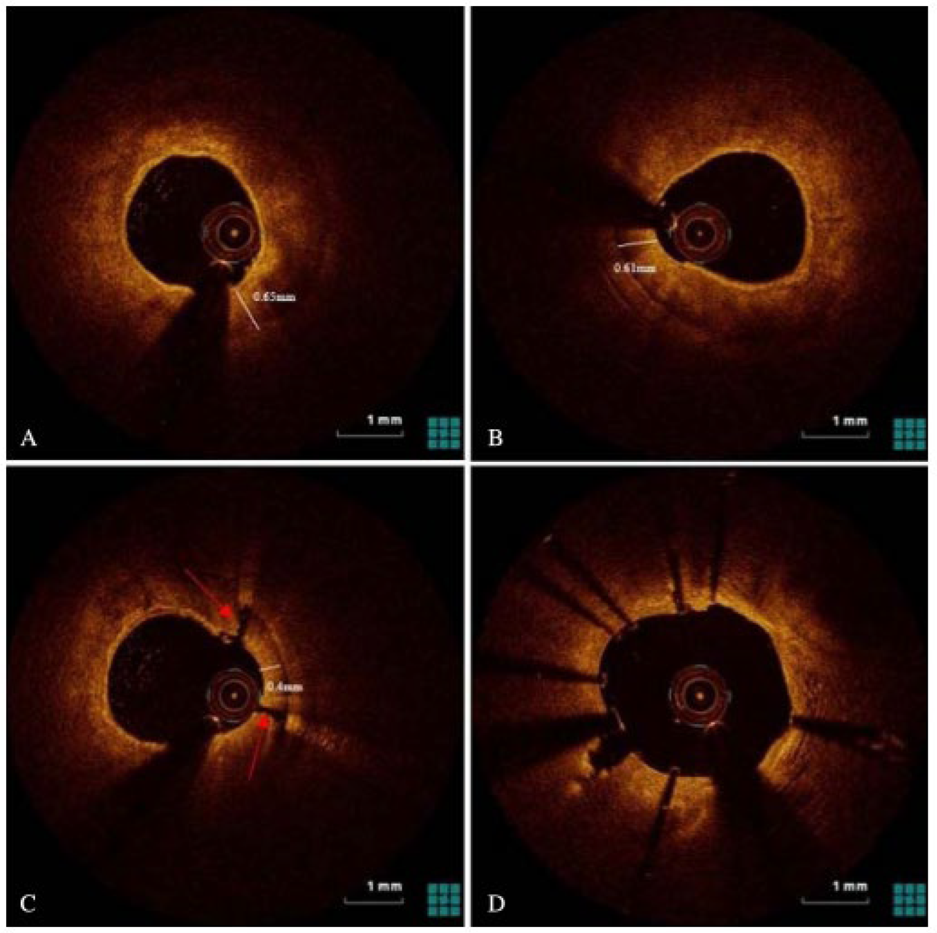 Jcm 14 08130 g008 Jcm 14 08130 g008