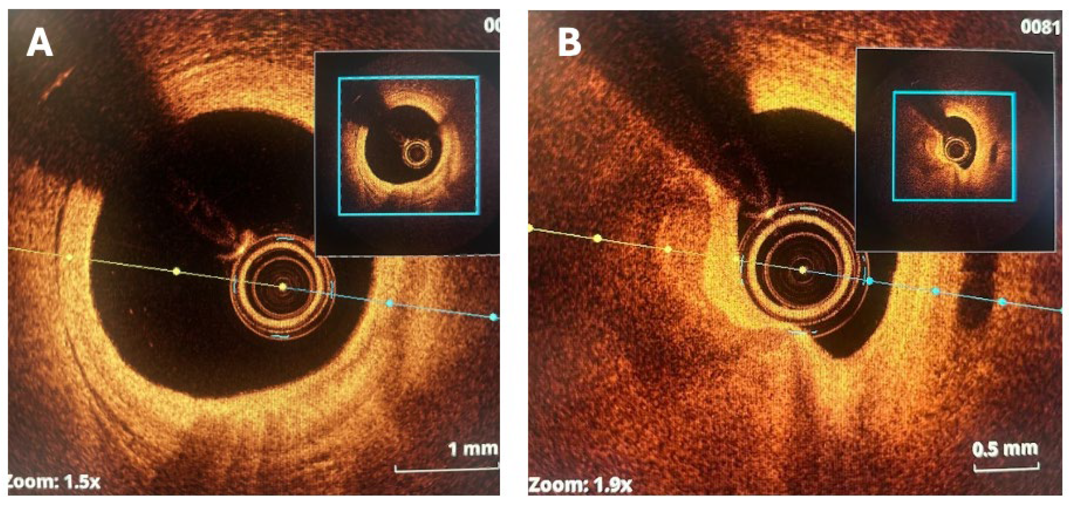 Jcm 14 08130 g009 Jcm 14 08130 g009