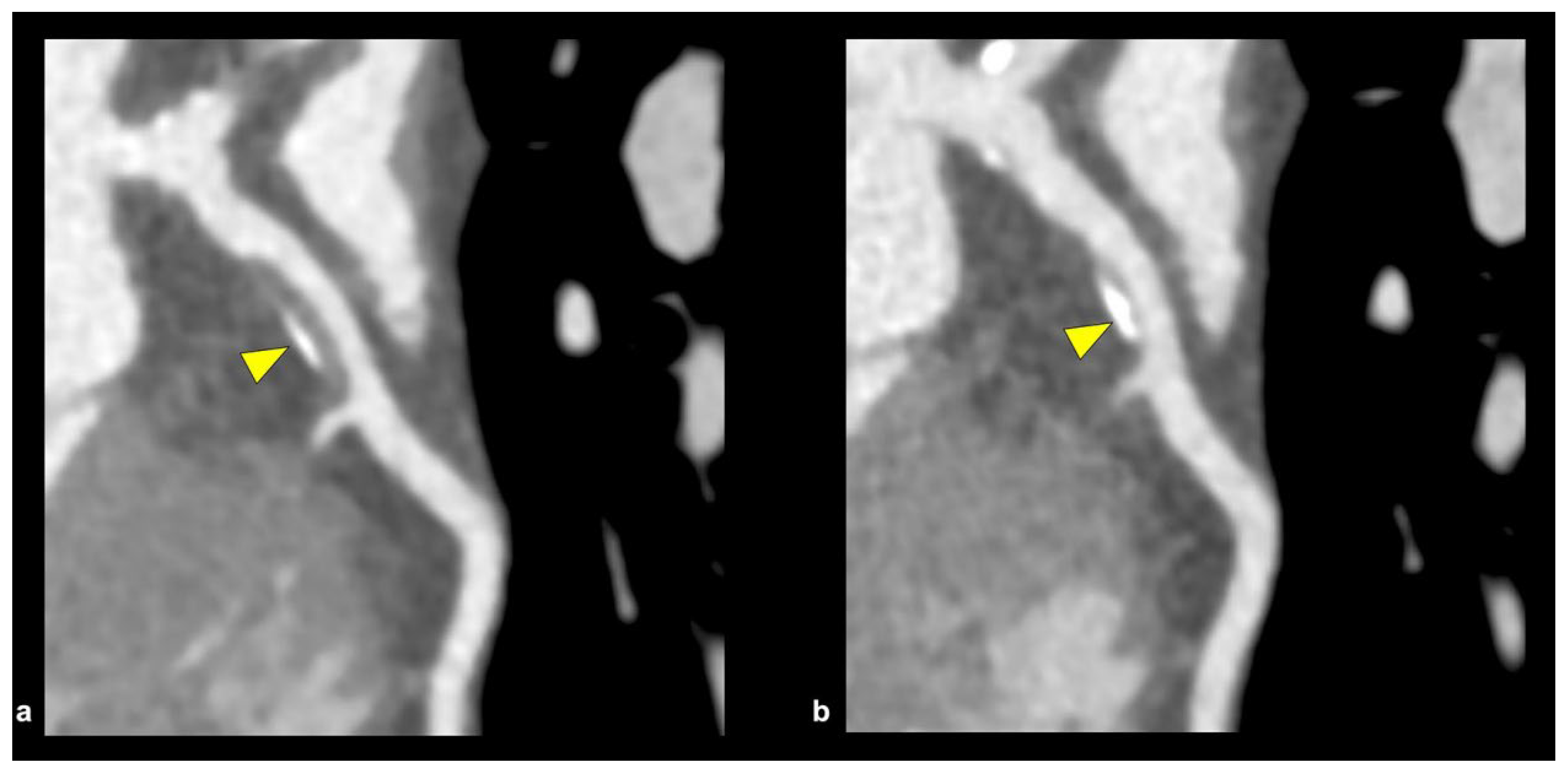 Jcm 14 08130 g010 Jcm 14 08130 g010