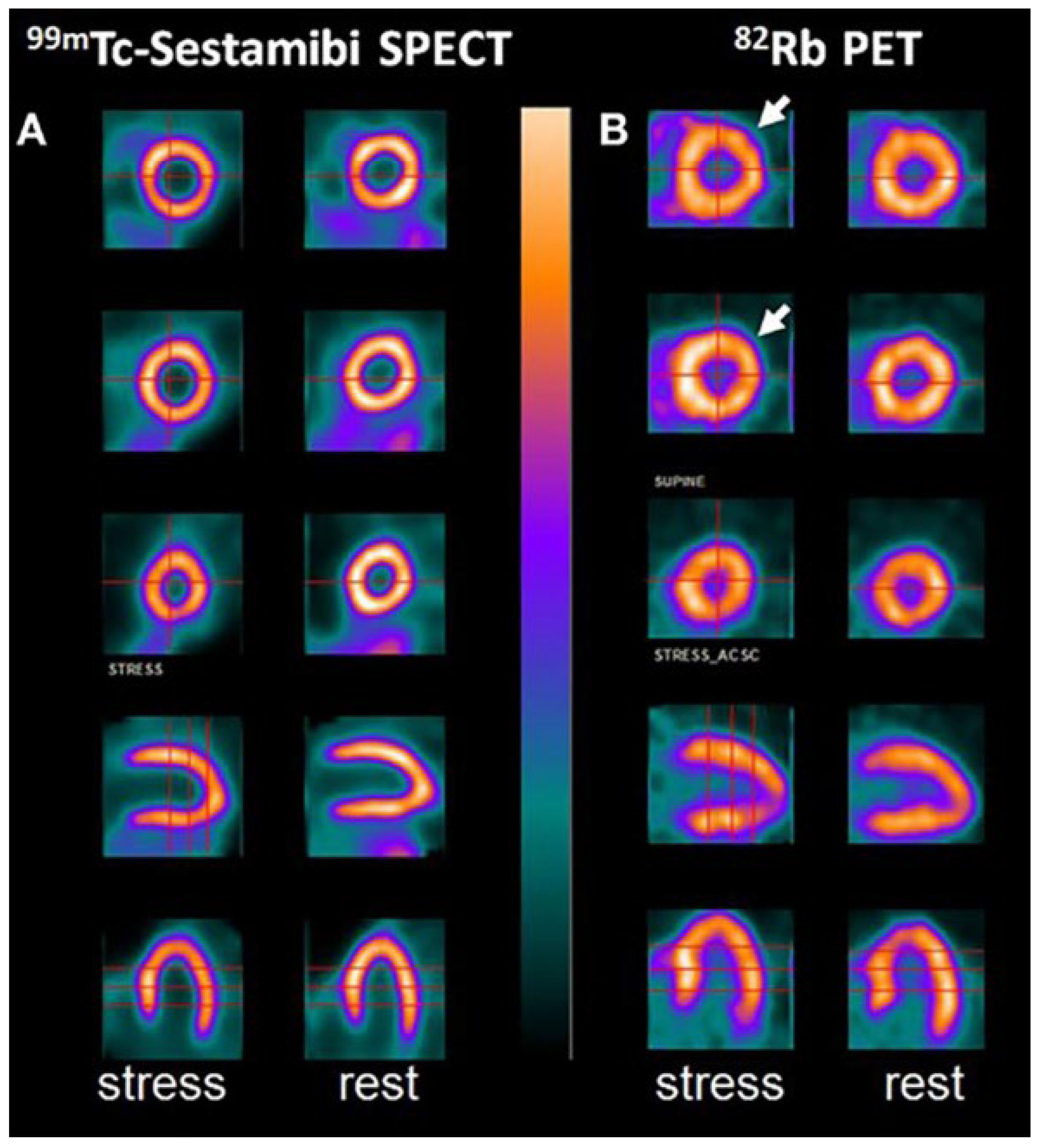 Jcm 14 08130 g011 Jcm 14 08130 g011