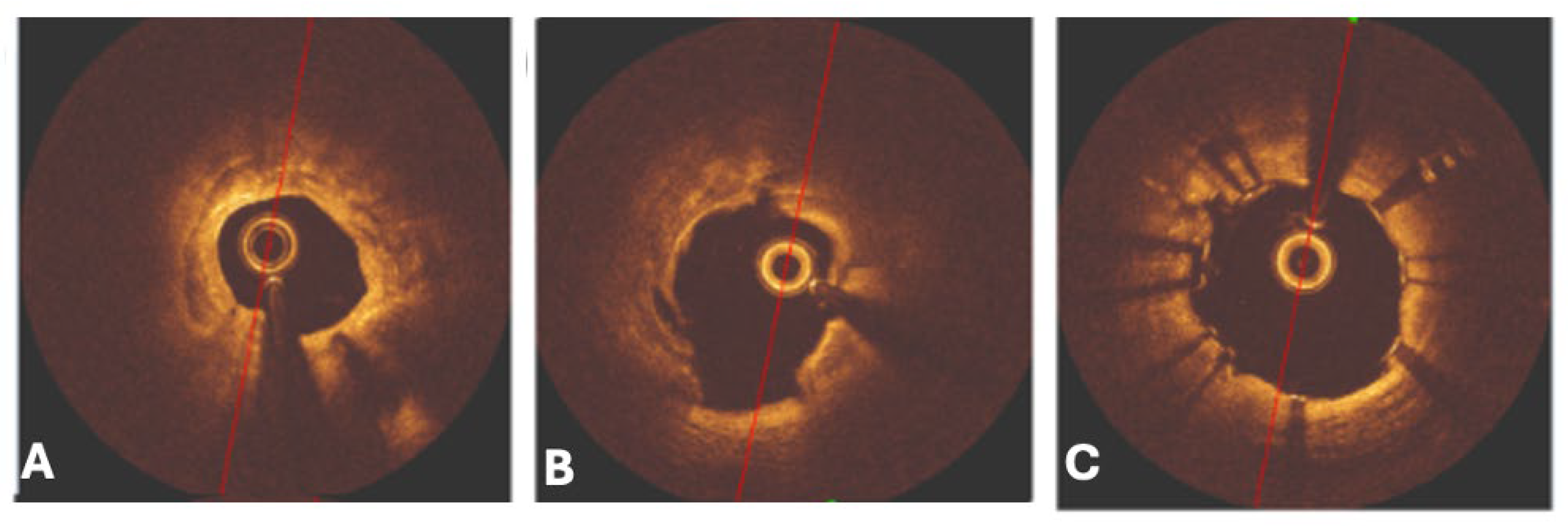 Jcm 14 08130 g016 Jcm 14 08130 g016