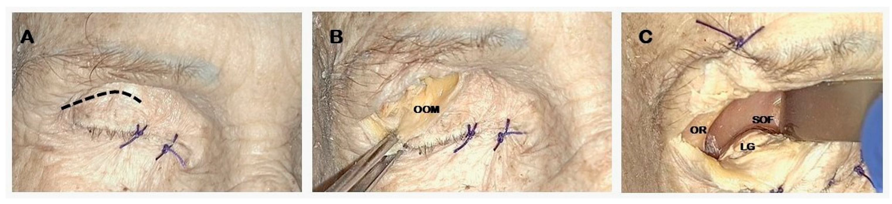 Jcm 14 08165 g001 Jcm 14 08165 g001