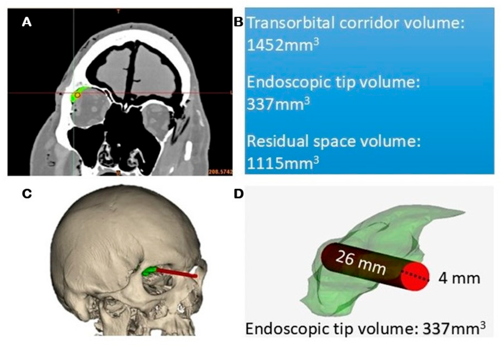 Jcm 14 08165 g006 Jcm 14 08165 g006