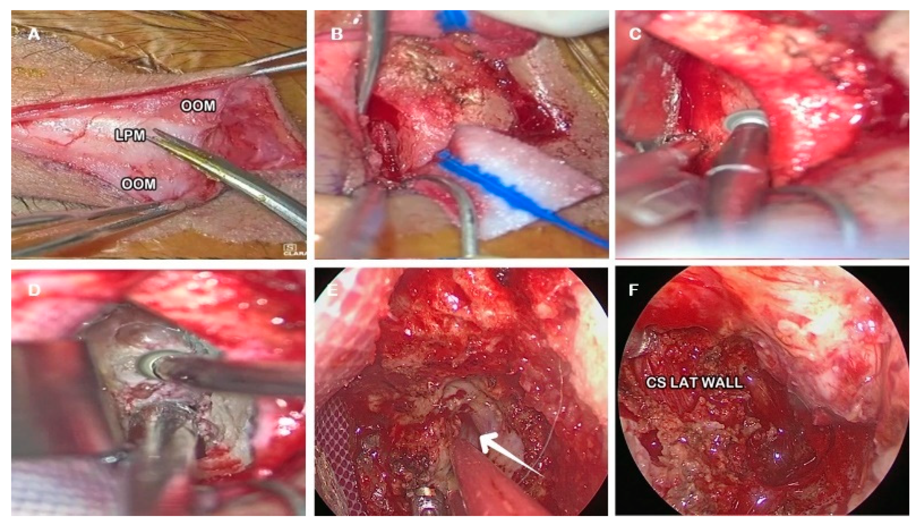 Jcm 14 08165 g007 Jcm 14 08165 g007