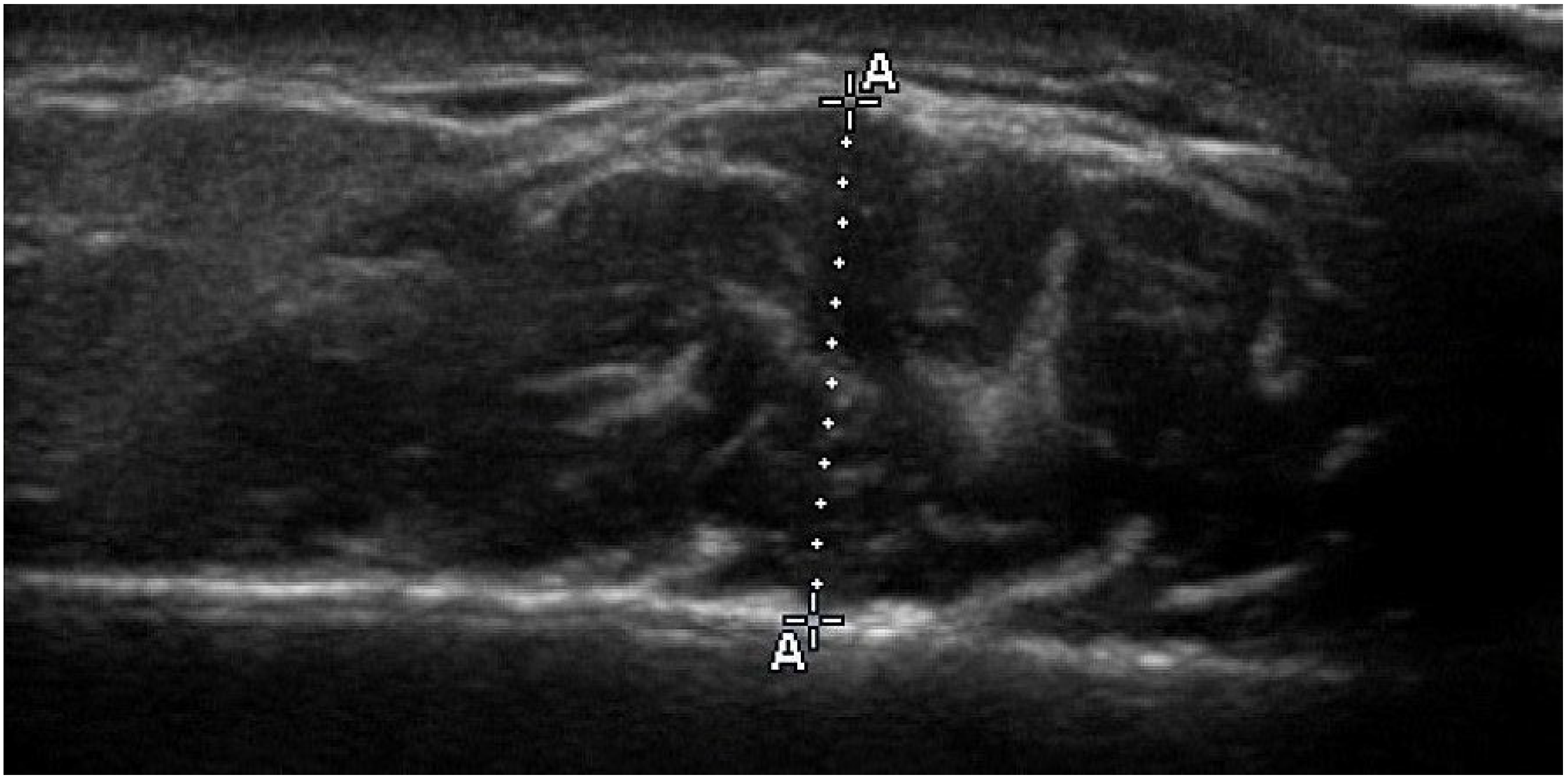 Jcm 14 08175 g001 Jcm 14 08175 g001