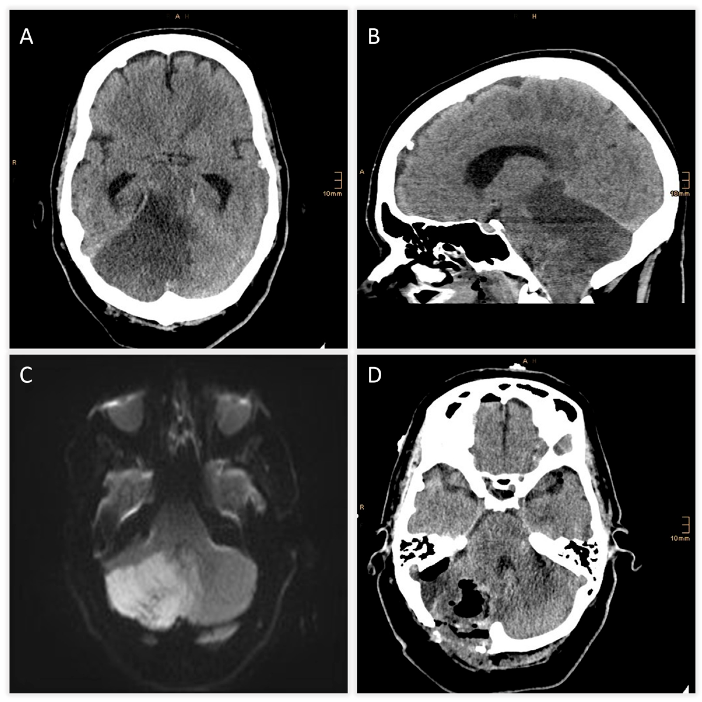 Jcm 14 08229 g002 Jcm 14 08229 g002