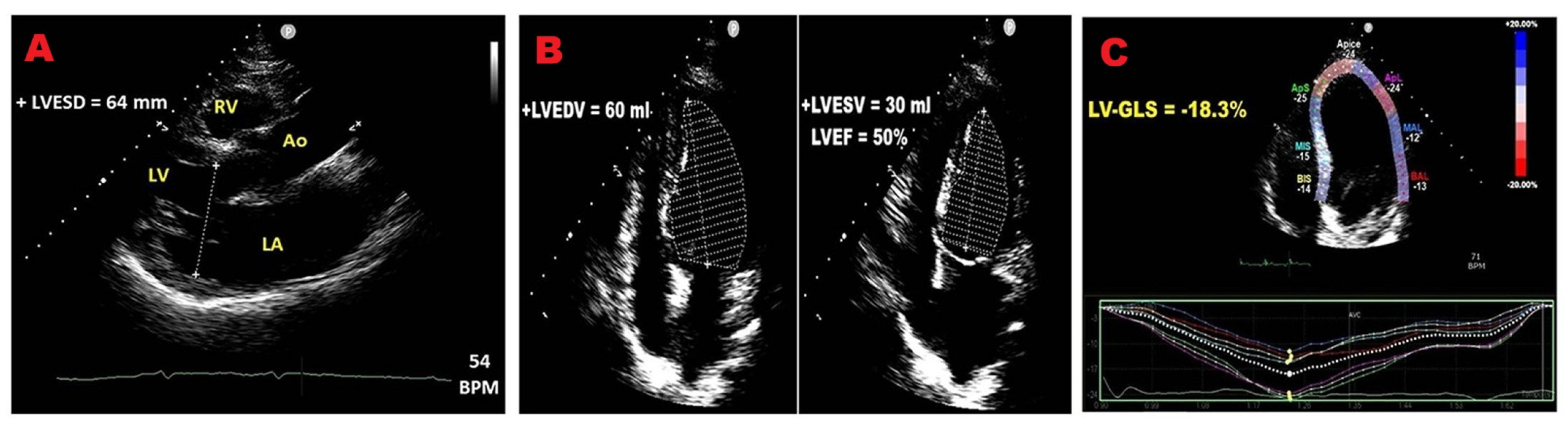 Jcm 14 08297 g002 Jcm 14 08297 g002