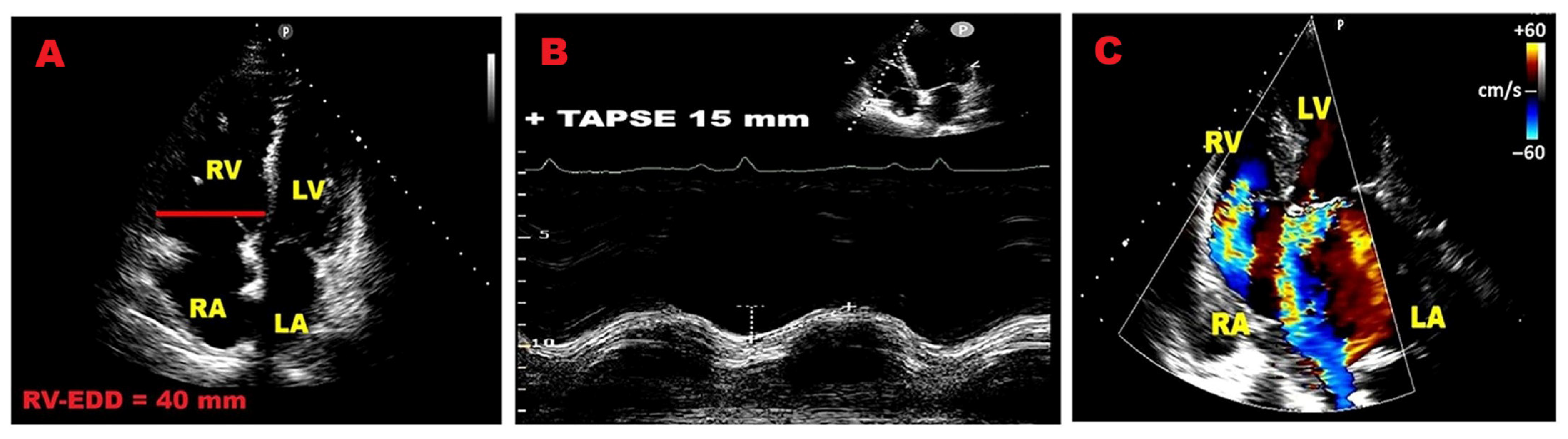 Jcm 14 08297 g004 Jcm 14 08297 g004