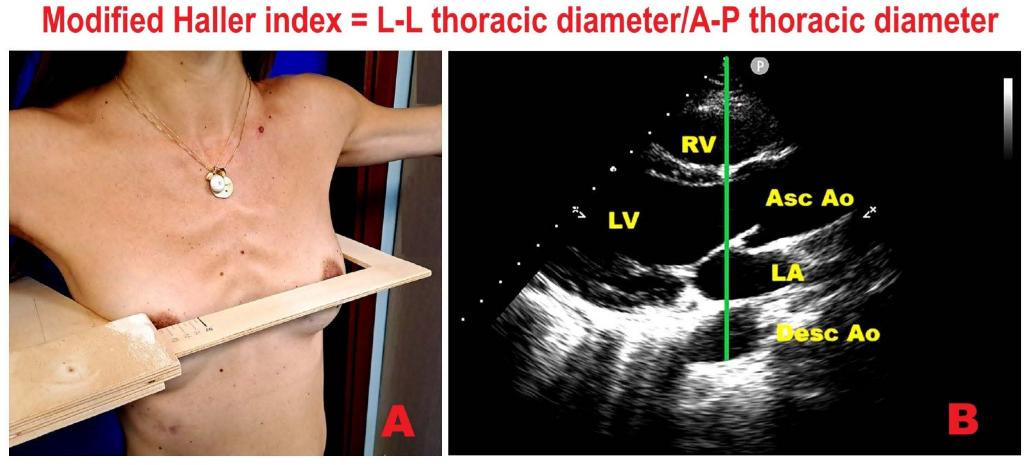 Jcm 14 08297 g005 Jcm 14 08297 g005