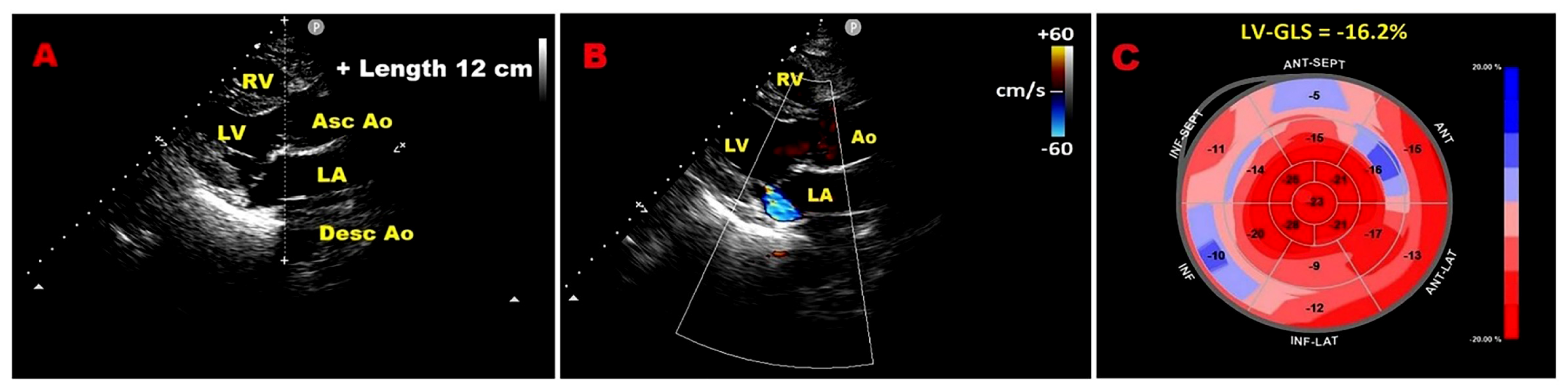 Jcm 14 08297 g006 Jcm 14 08297 g006