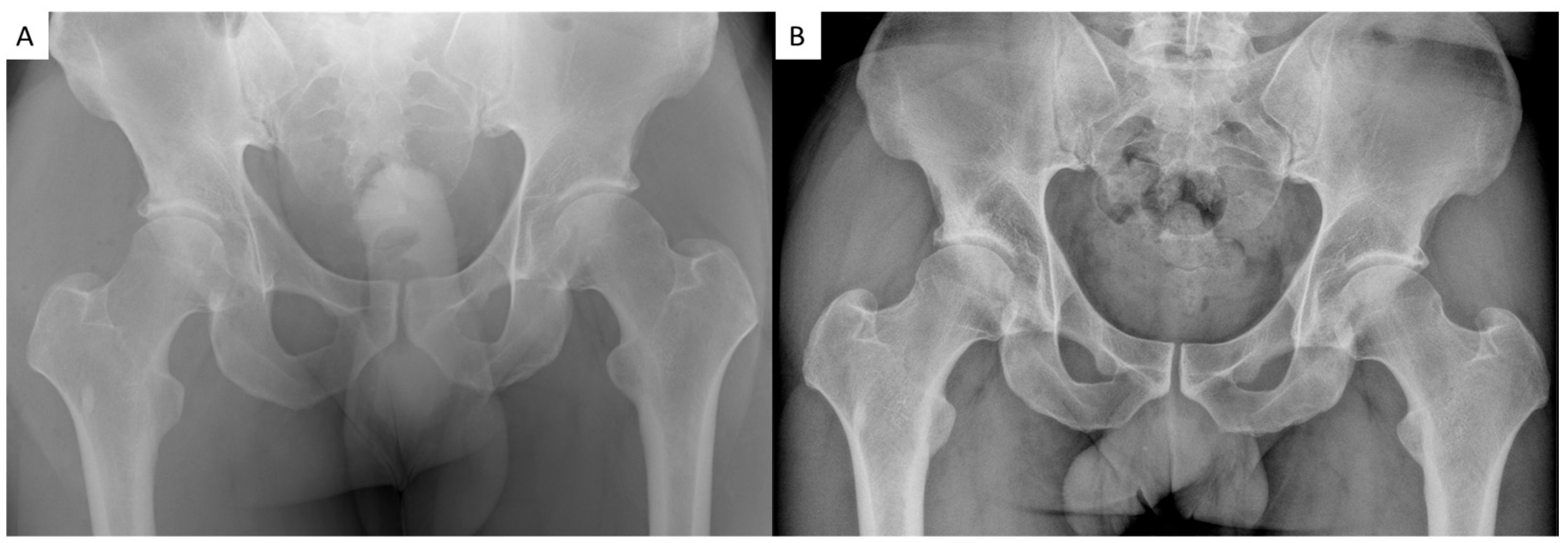 Jcm 14 08298 g004 Jcm 14 08298 g004