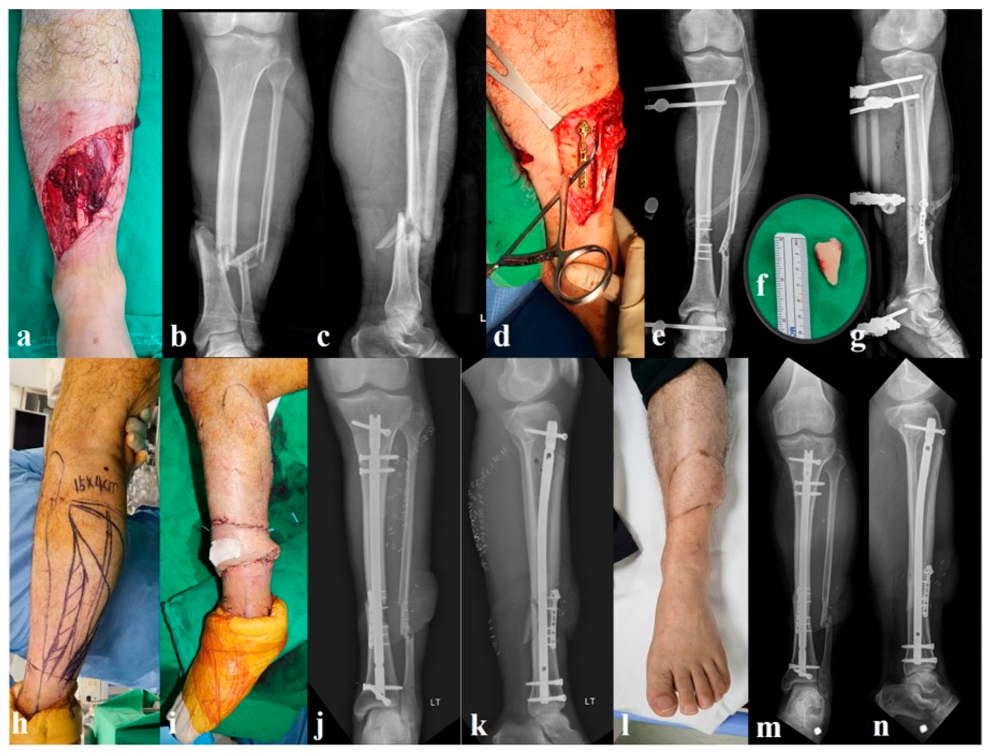 Jcm 14 08421 g001 Jcm 14 08421 g001