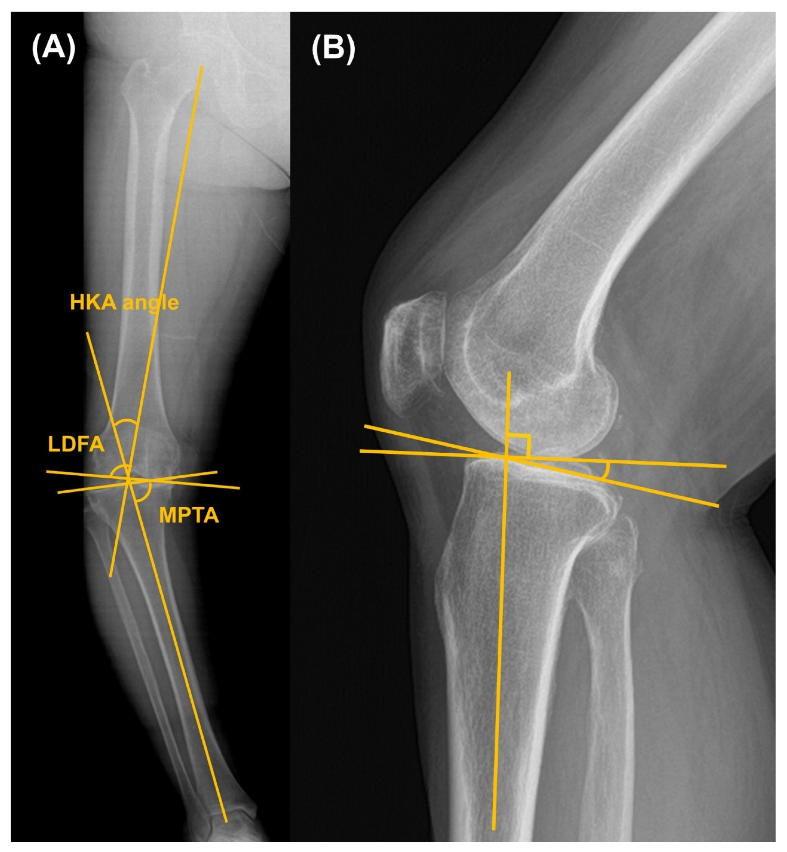 Jcm 14 08450 g002 Jcm 14 08450 g002