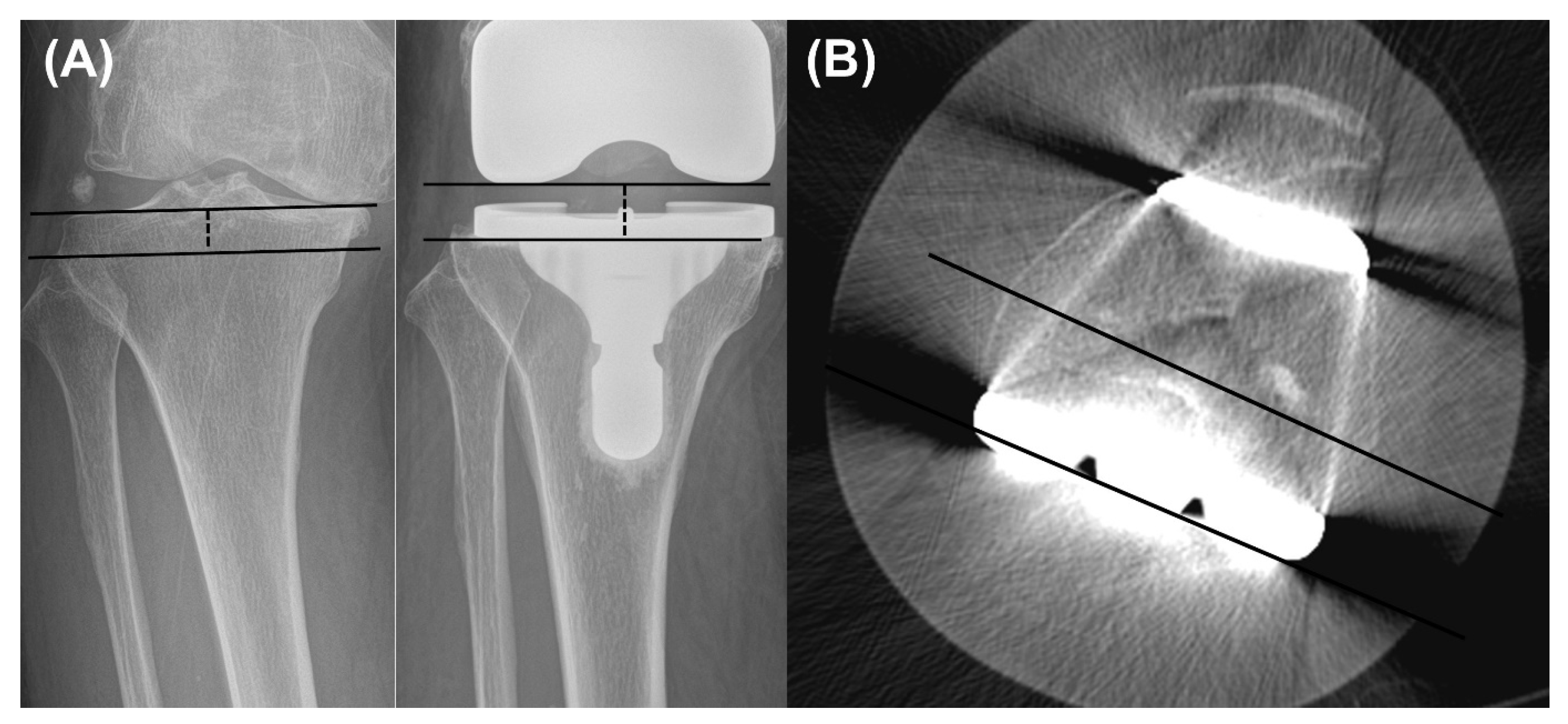 Jcm 14 08450 g003 Jcm 14 08450 g003